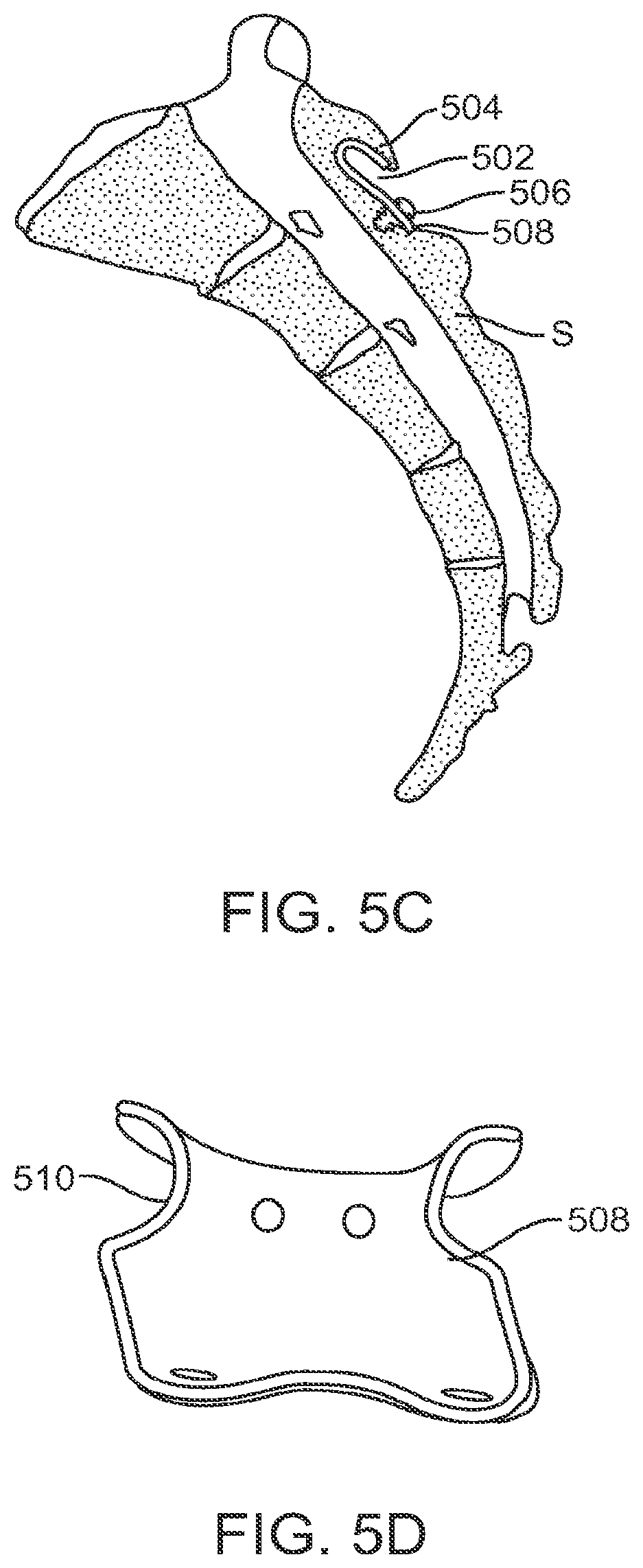 Patent US12599421 Figure 7 – Sacral tether anchor and methods of use