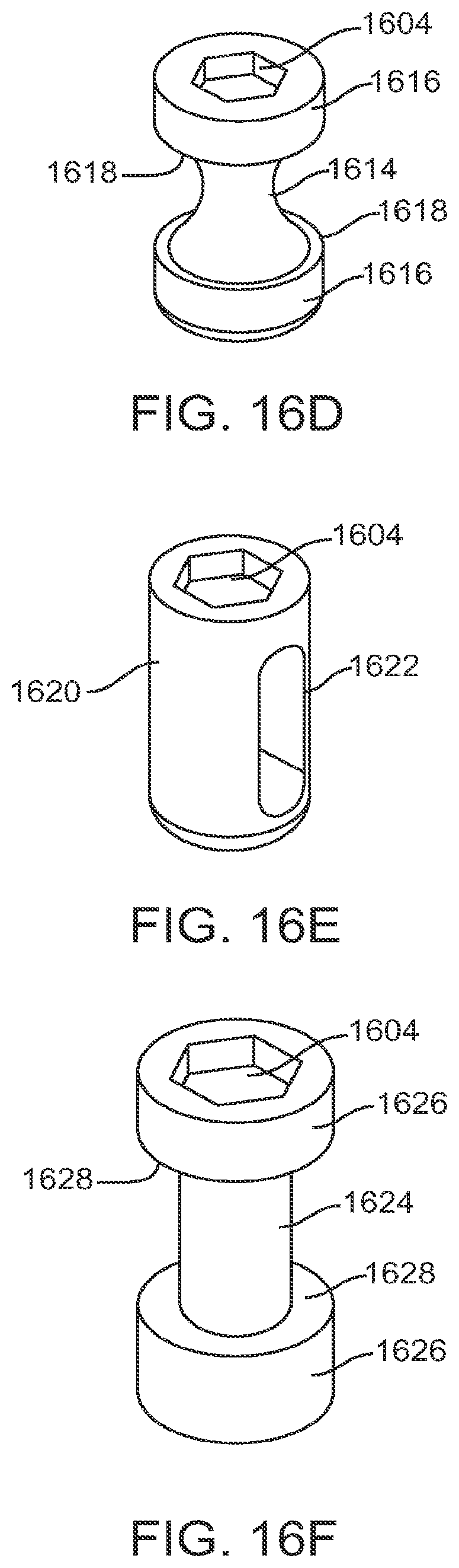 Patent US12599421 Figure 19 – Sacral tether anchor and methods of use