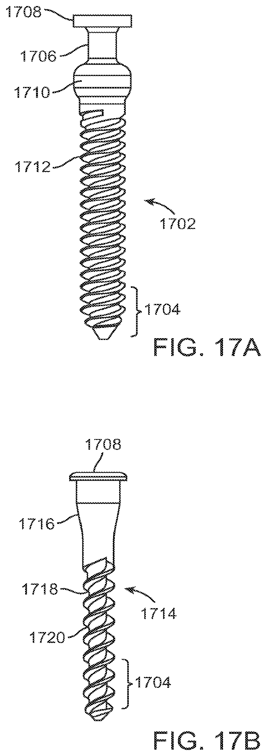 Patent US12599421 Figure 20 – Sacral tether anchor and methods of use