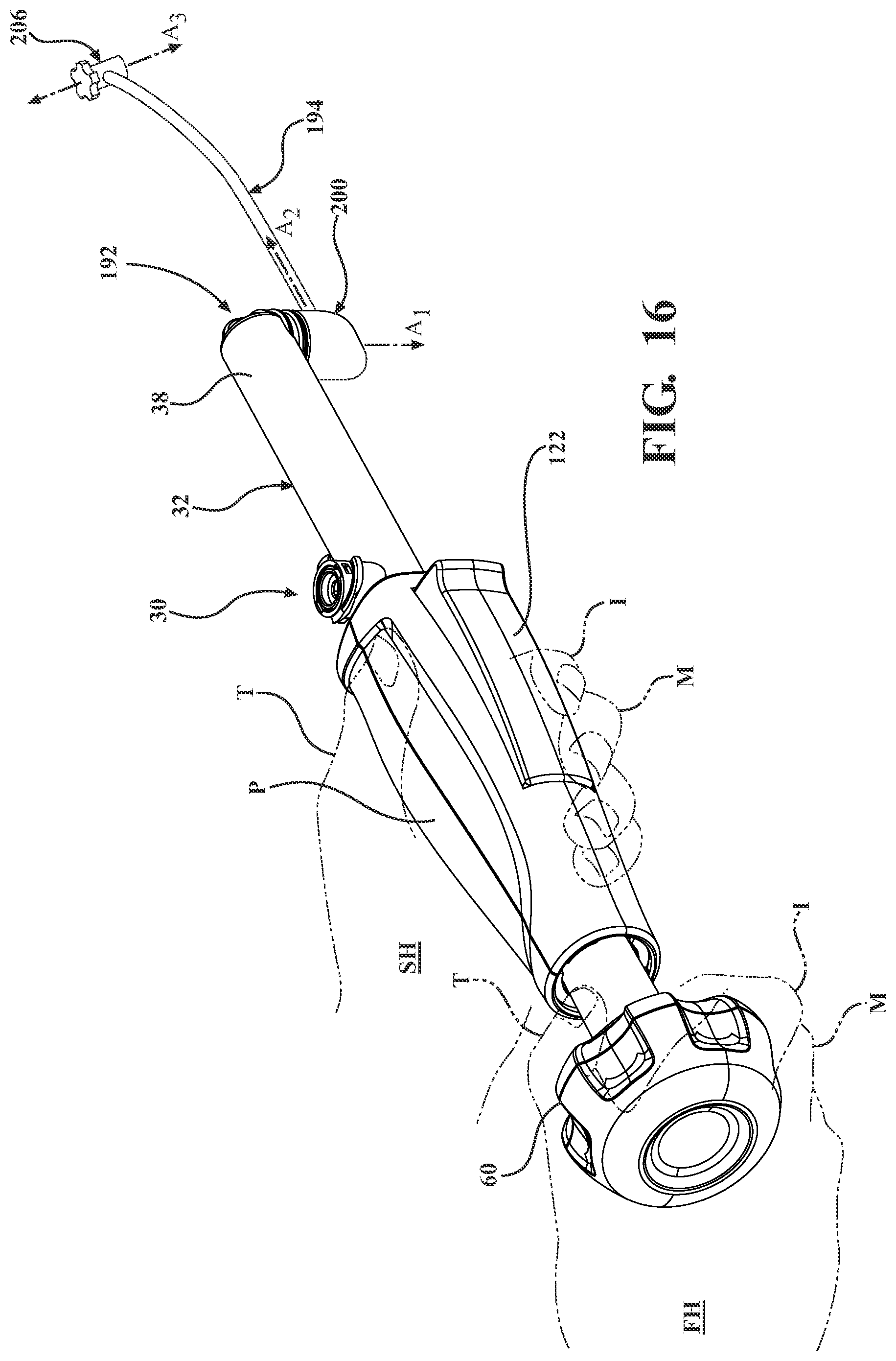 Patent US12599422 Figure 15 – Curable material dispensing system and methods of operating and packaging the same