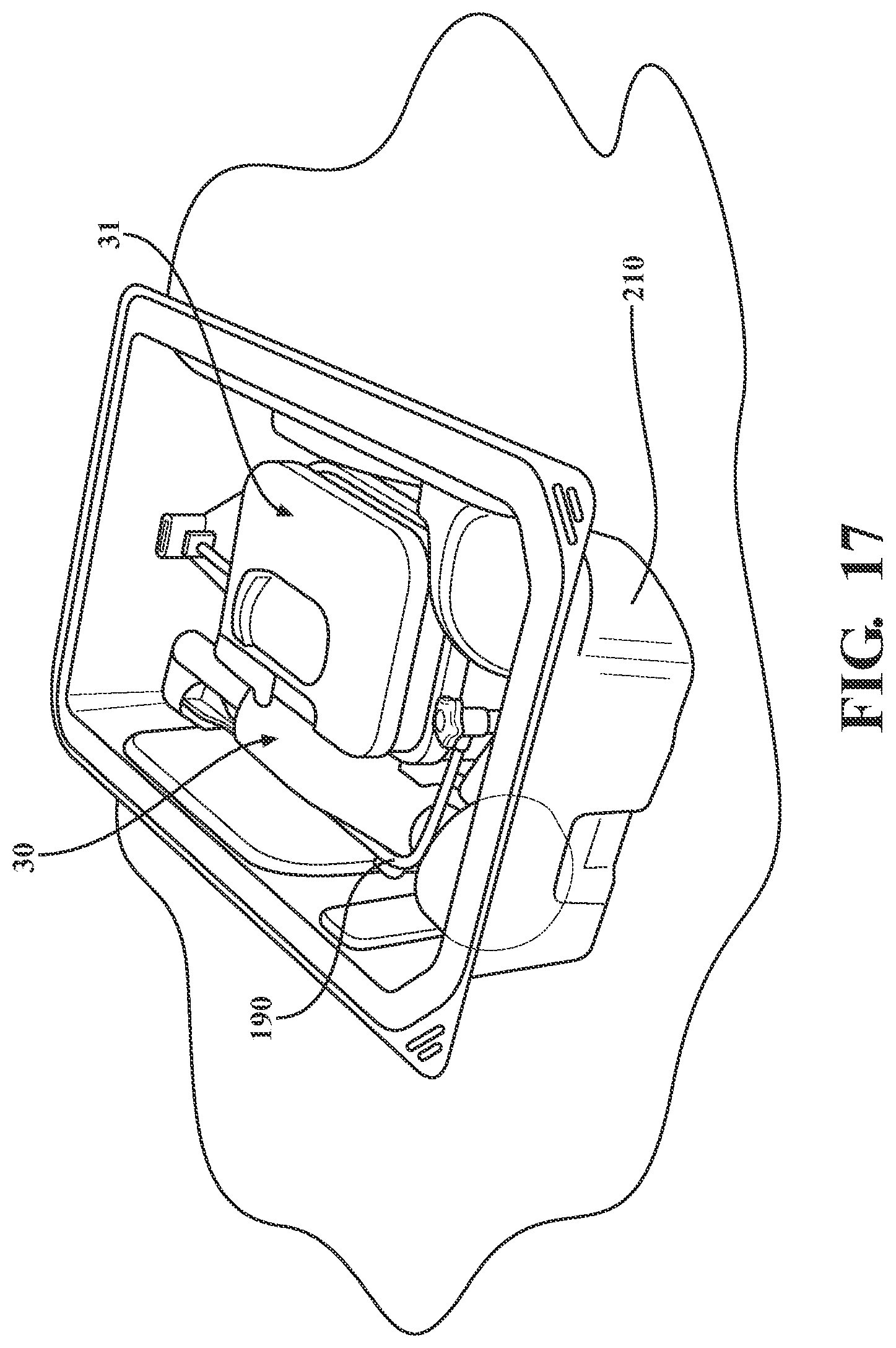 Patent US12599422 Figure 16 – Curable material dispensing system and methods of operating and packaging the same