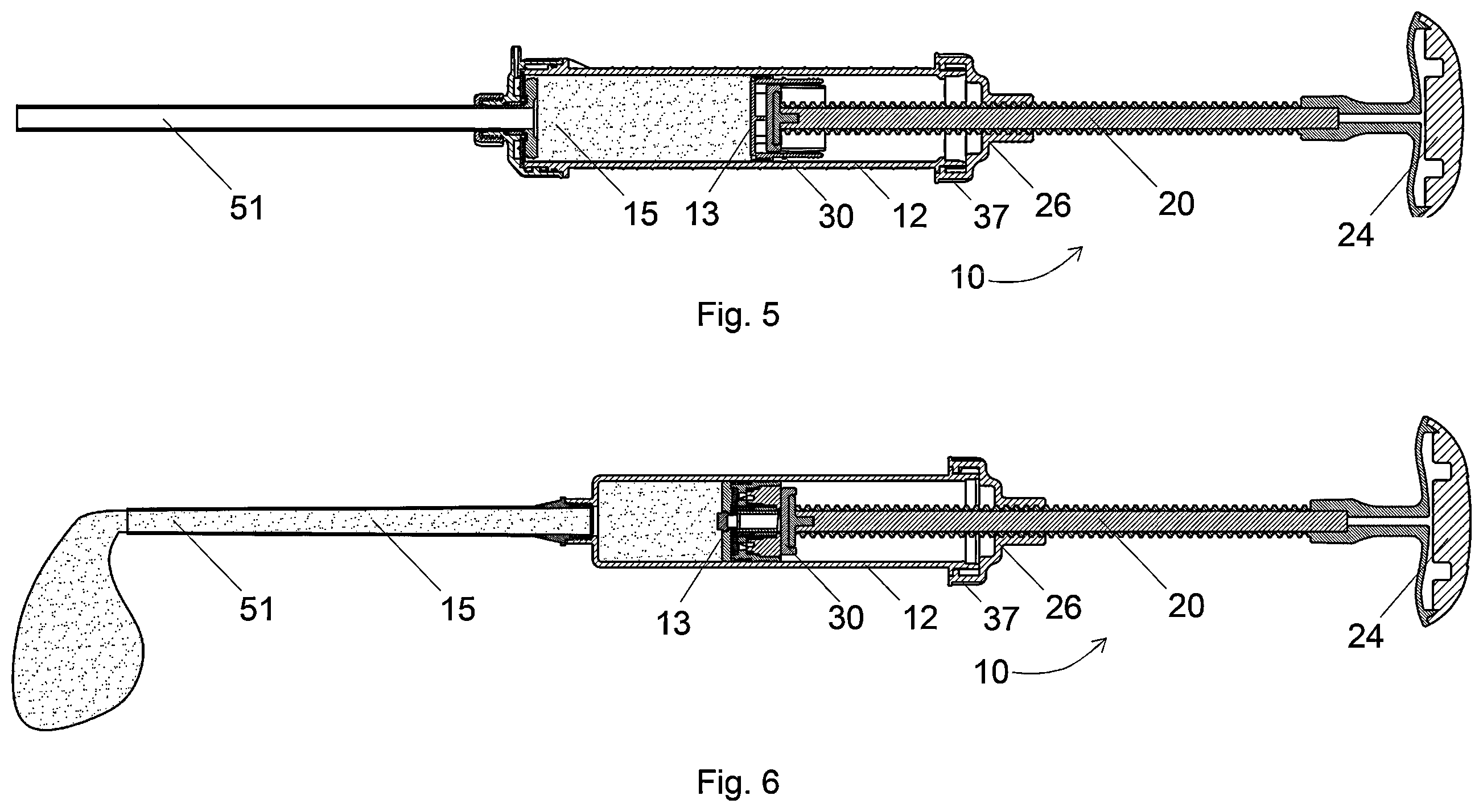 Patent US12599423 Figure 4 – Apparatus for pressing out bone cement, use and system