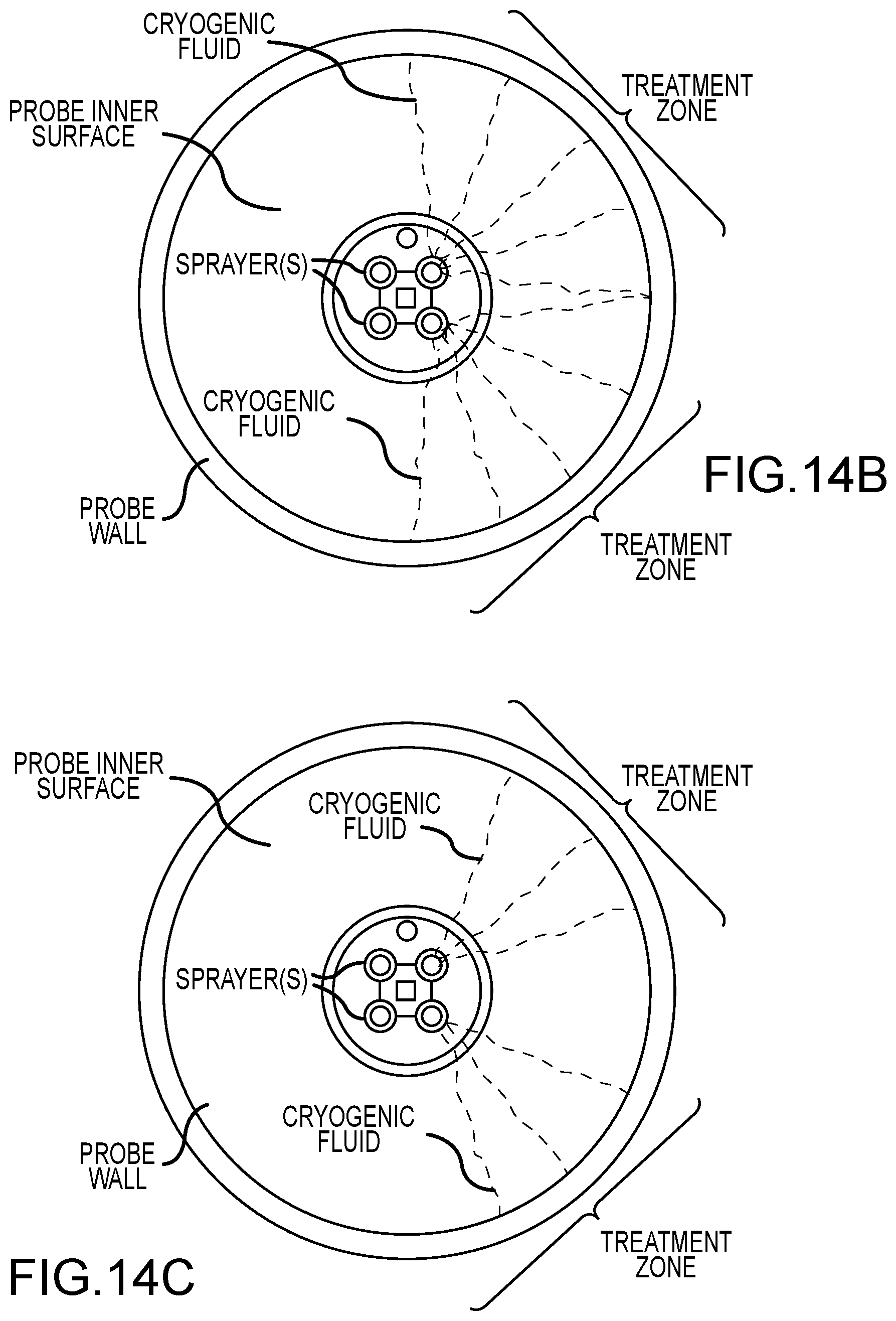 Patent US12599424 Figure 10 – Cryogenic catheter probe, system, and method for selective ablation of mucosa and submucosa of the gastrointestinal tract
