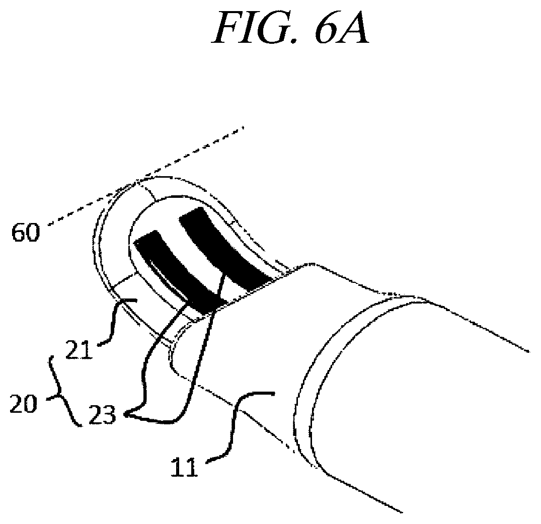 Patent US12599425 Figure 7 – Systems for perivascular nerve denervation