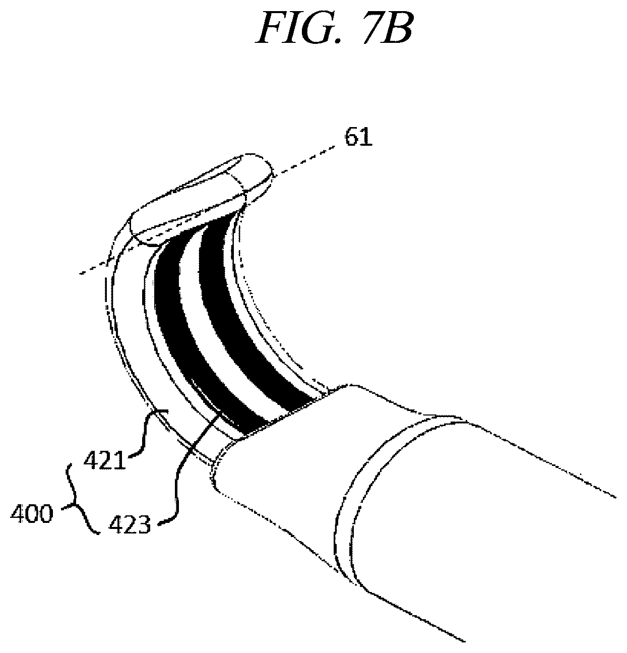 Patent US12599425 Figure 12 – Systems for perivascular nerve denervation