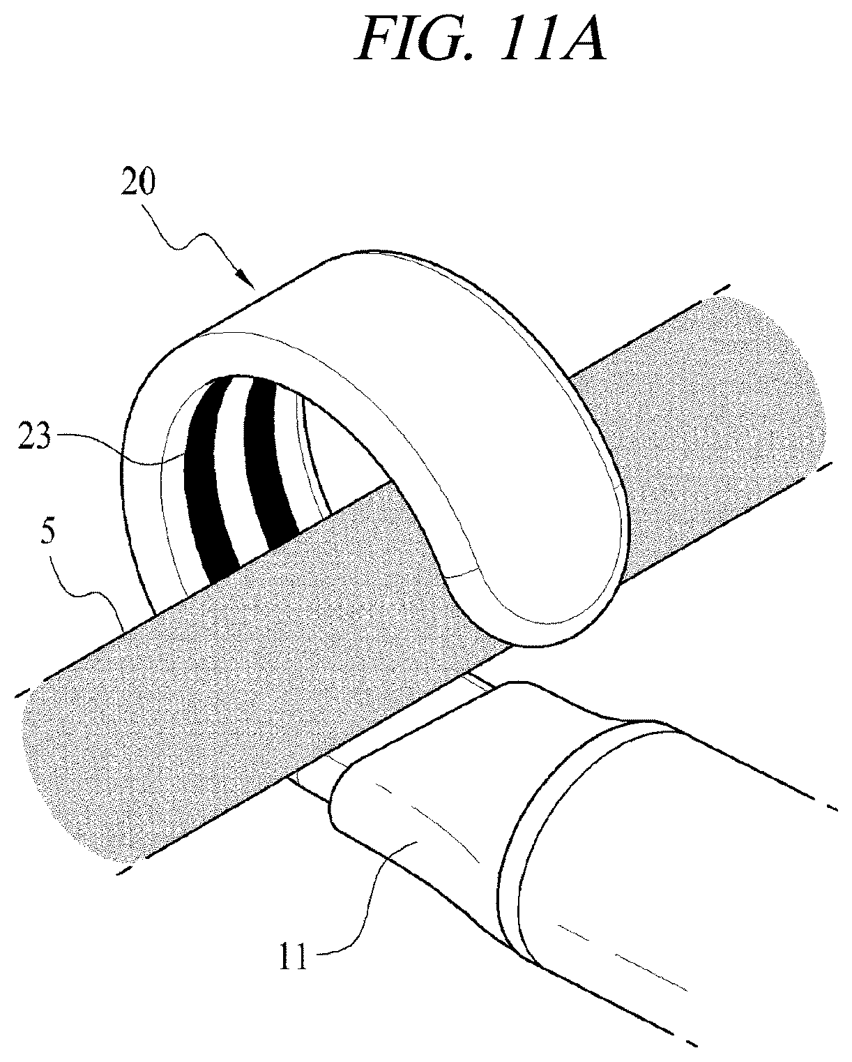Patent US12599425 Figure 18 – Systems for perivascular nerve denervation