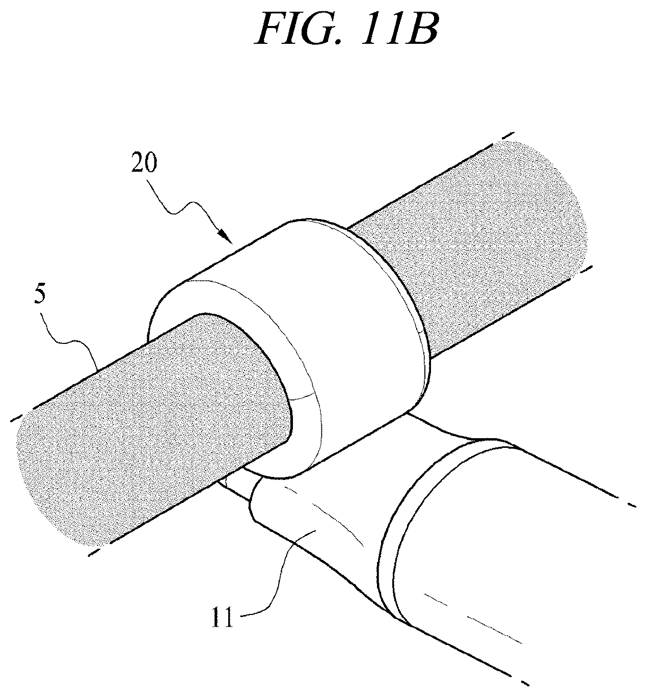 Patent US12599425 Figure 19 – Systems for perivascular nerve denervation