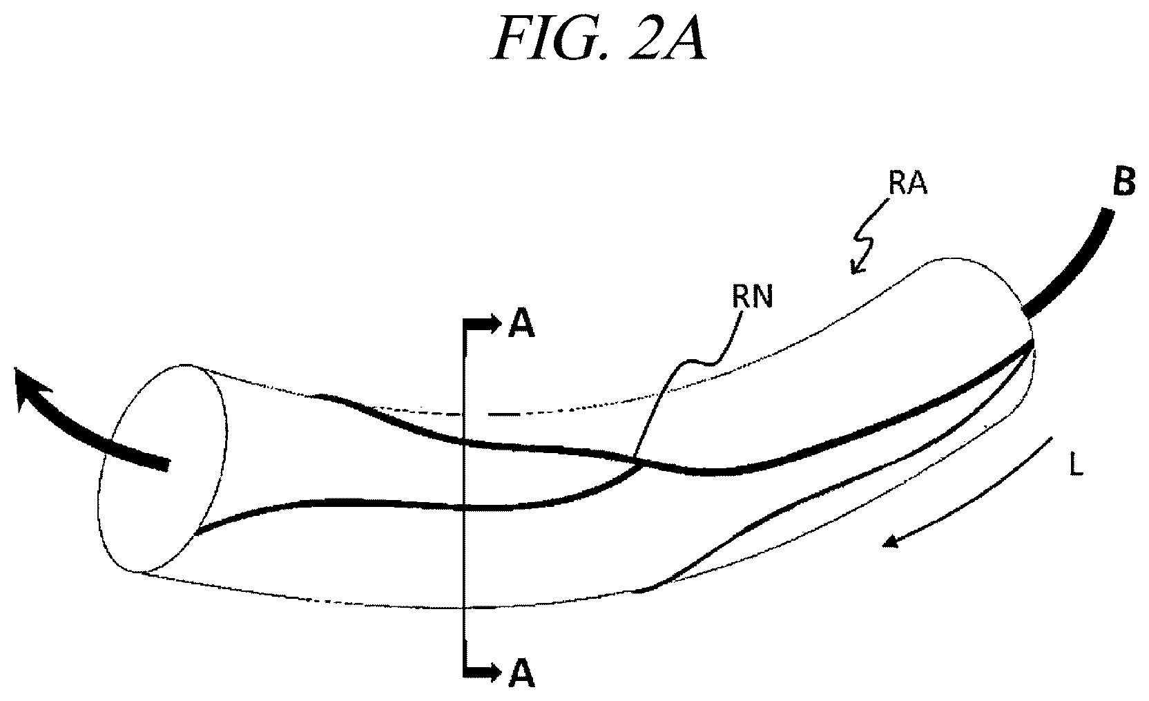 Patent US12599430 Figure 2 – Systems and methods for perivascular nerve denervation