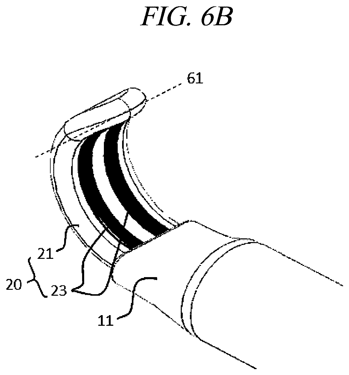Patent US12599430 Figure 8 – Systems and methods for perivascular nerve denervation