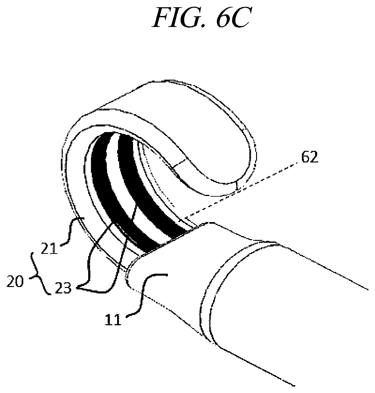 Patent US12599430 Figure 9 – Systems and methods for perivascular nerve denervation
