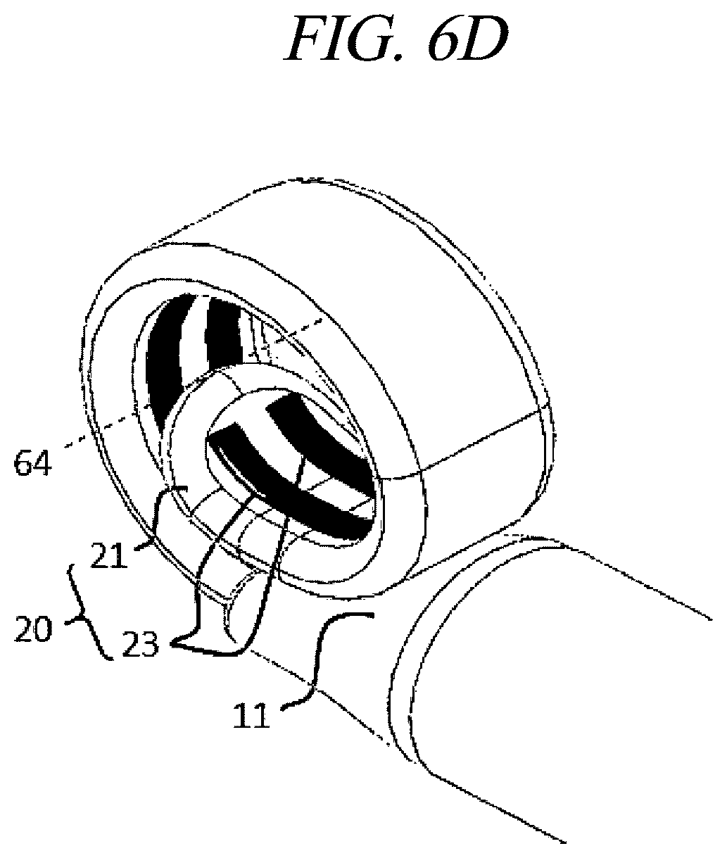 Patent US12599430 Figure 10 – Systems and methods for perivascular nerve denervation