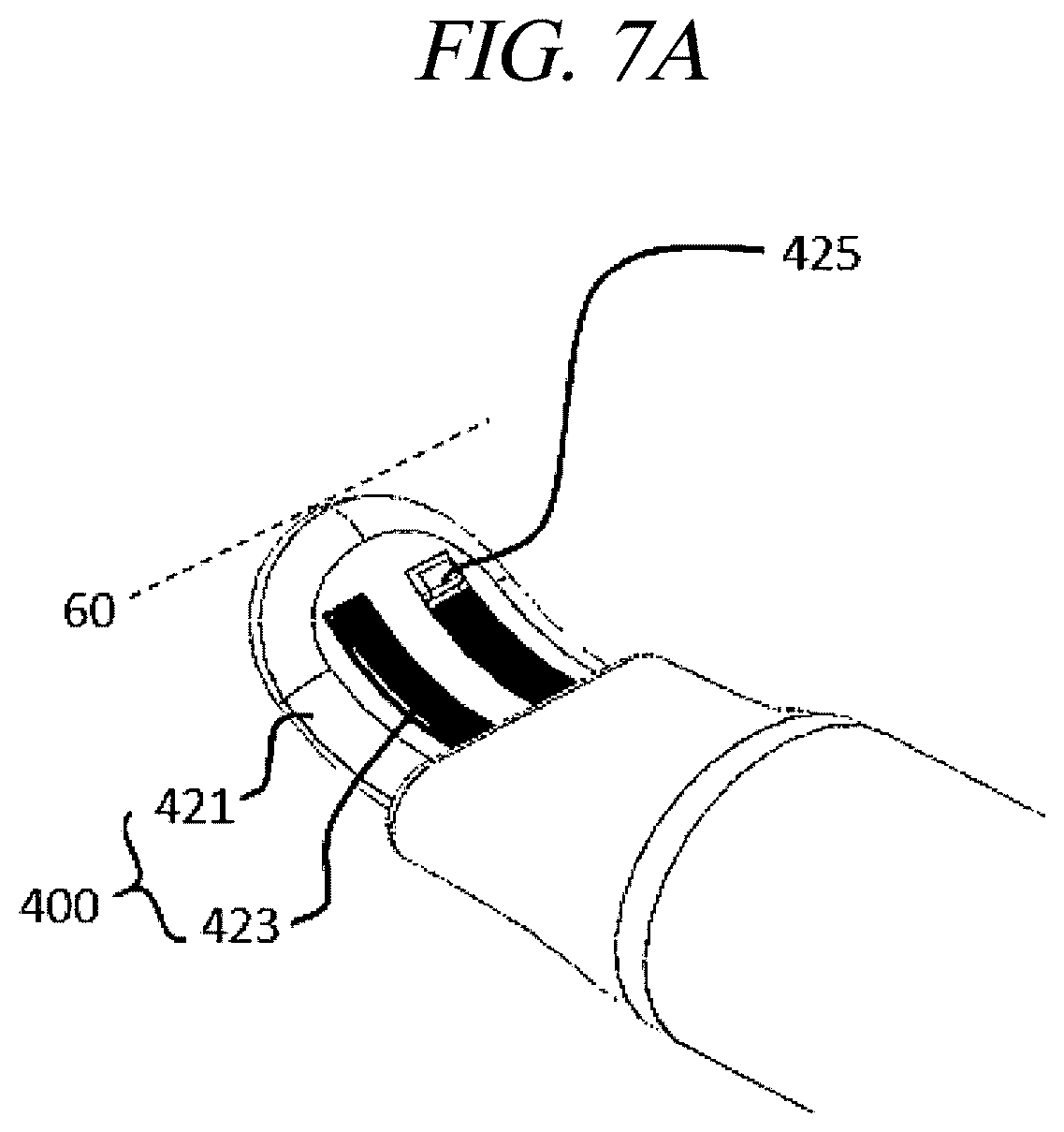 Patent US12599430 Figure 11 – Systems and methods for perivascular nerve denervation