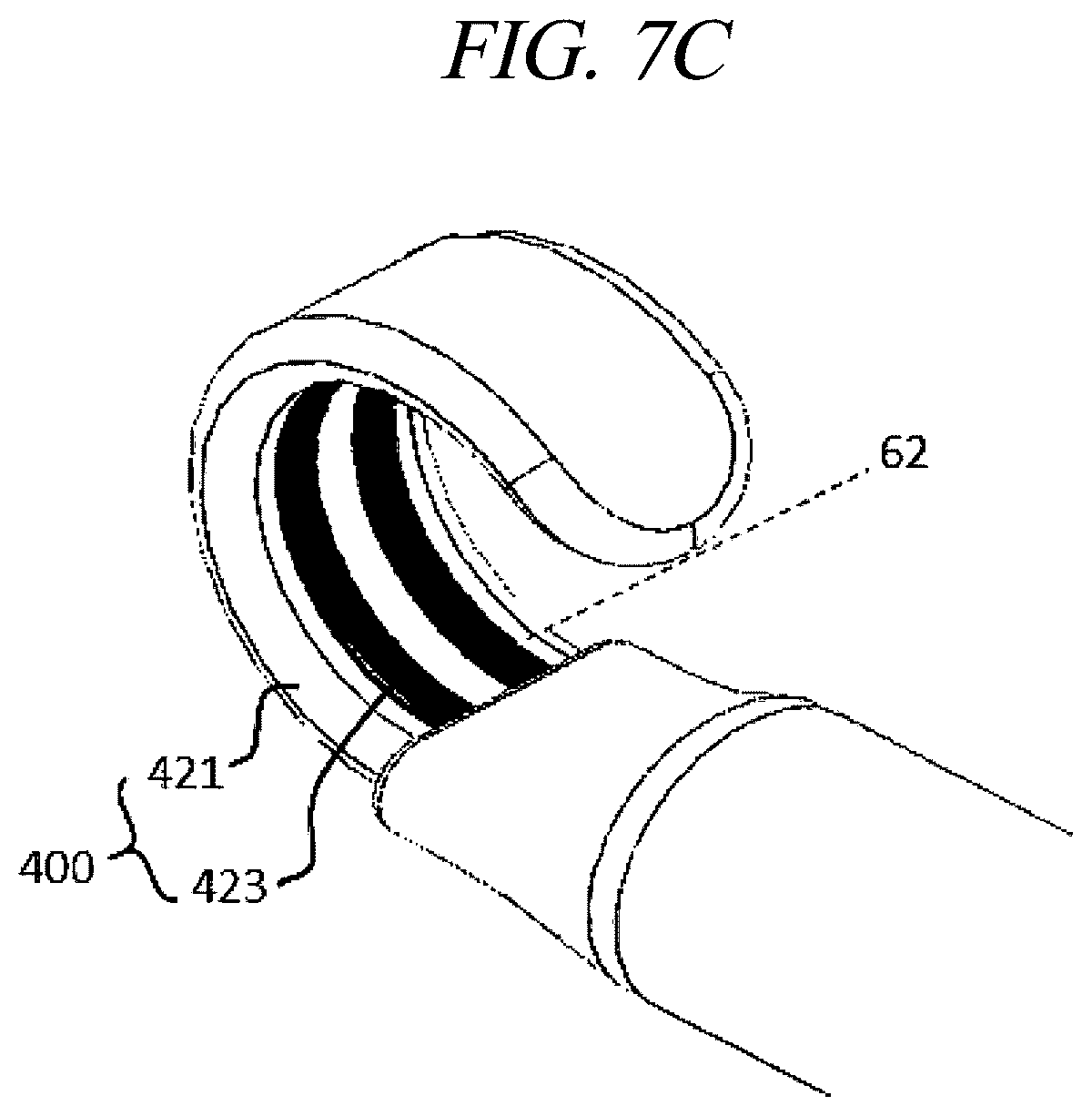 Patent US12599430 Figure 13 – Systems and methods for perivascular nerve denervation