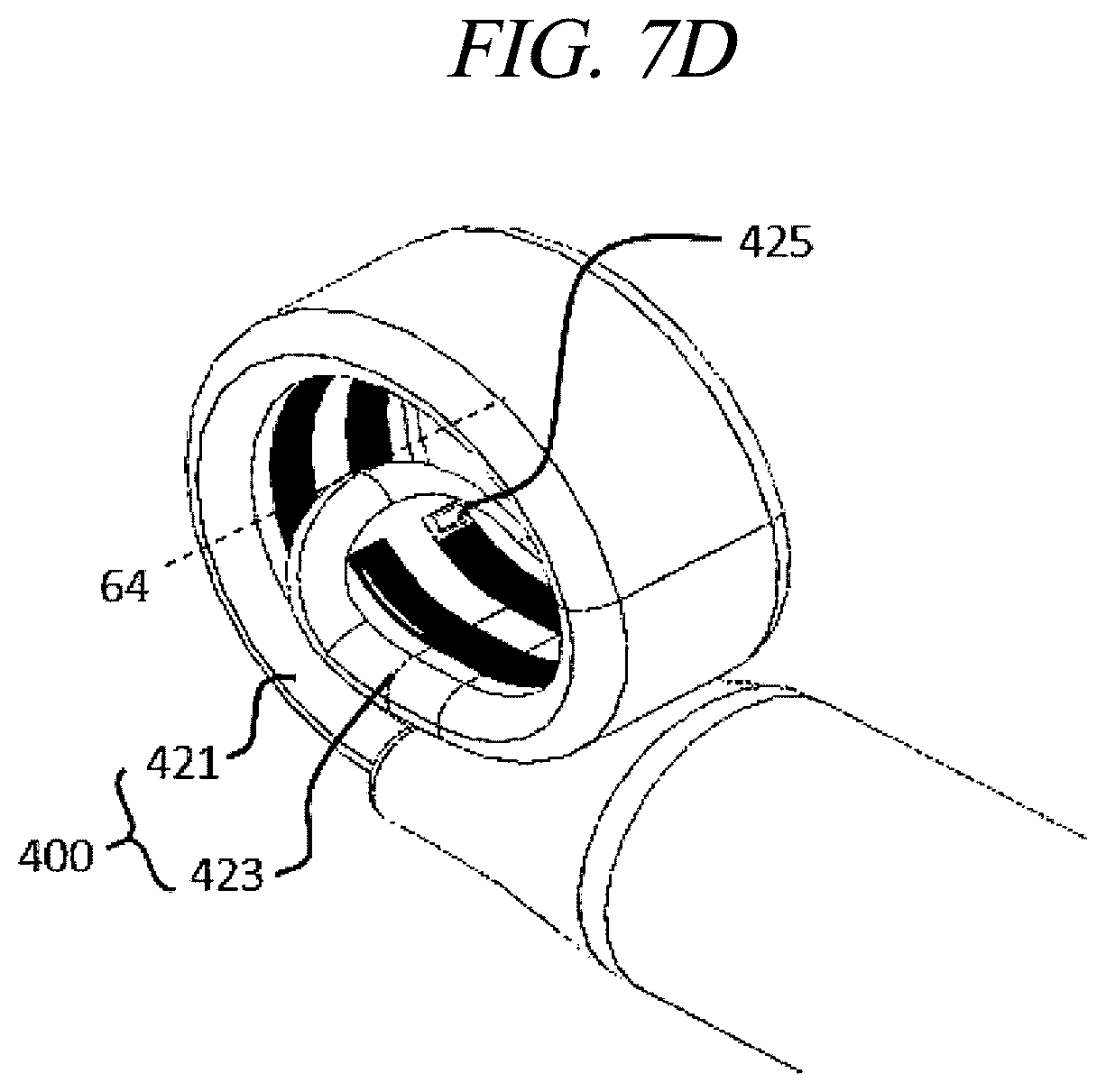 Patent US12599430 Figure 14 – Systems and methods for perivascular nerve denervation