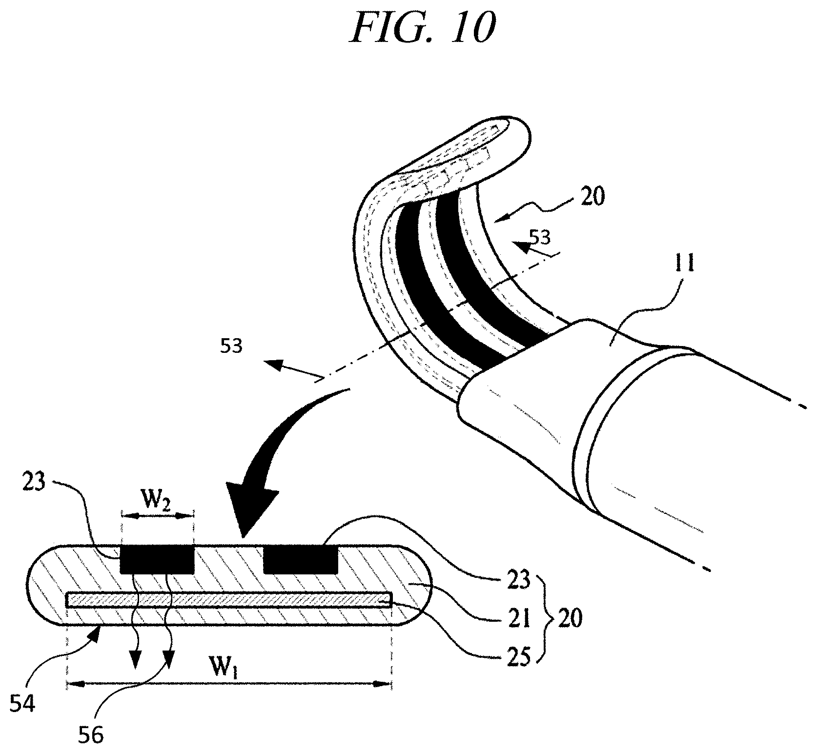 Patent US12599430 Figure 17 – Systems and methods for perivascular nerve denervation
