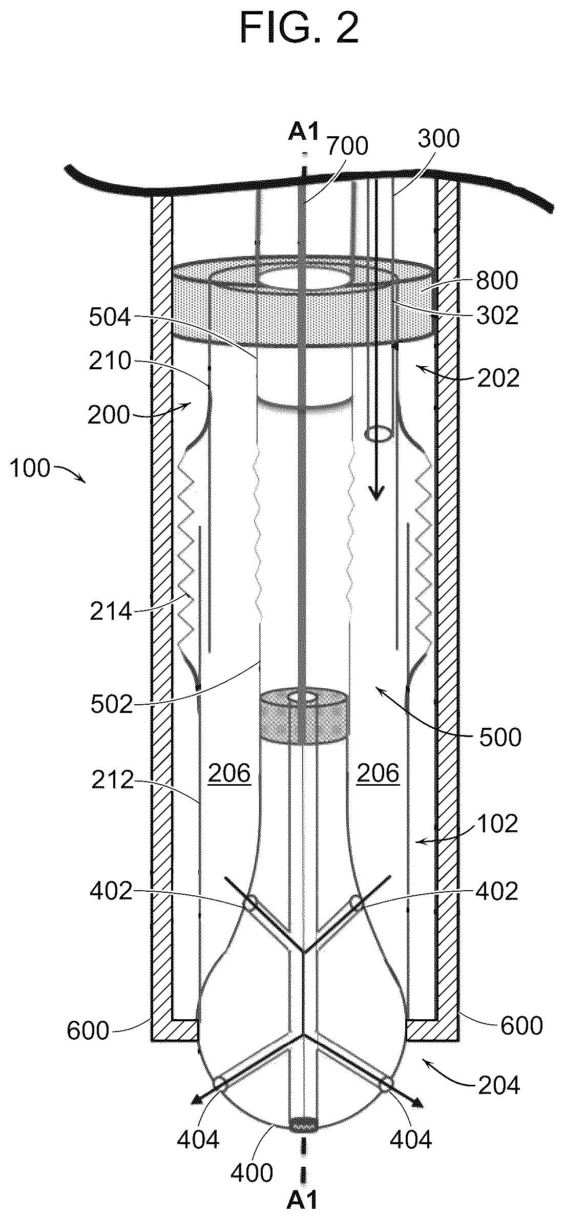 Patent US12599431 Figure 2 – Catheter and method for improved irrigation