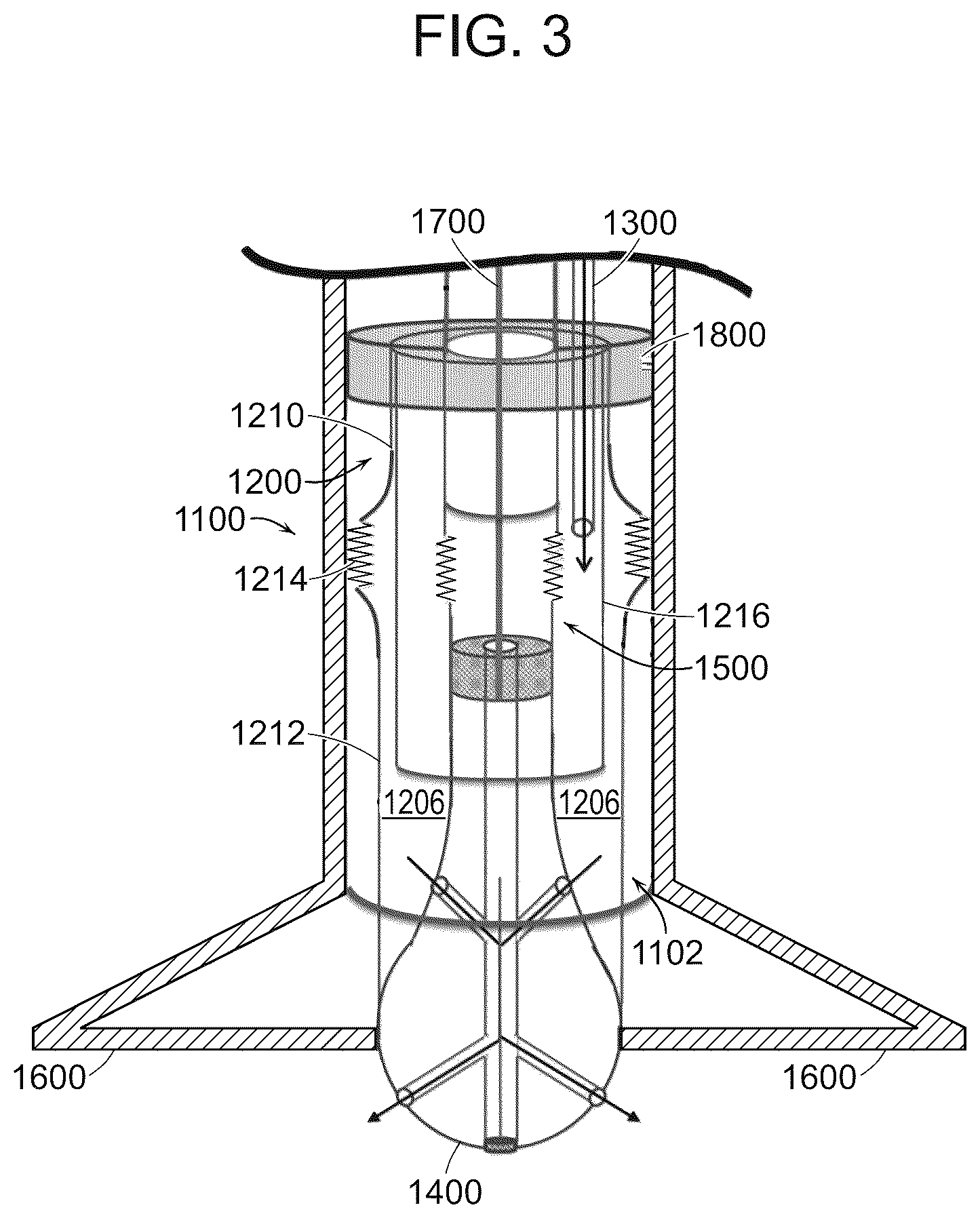 Patent US12599431 Figure 3 – Catheter and method for improved irrigation
