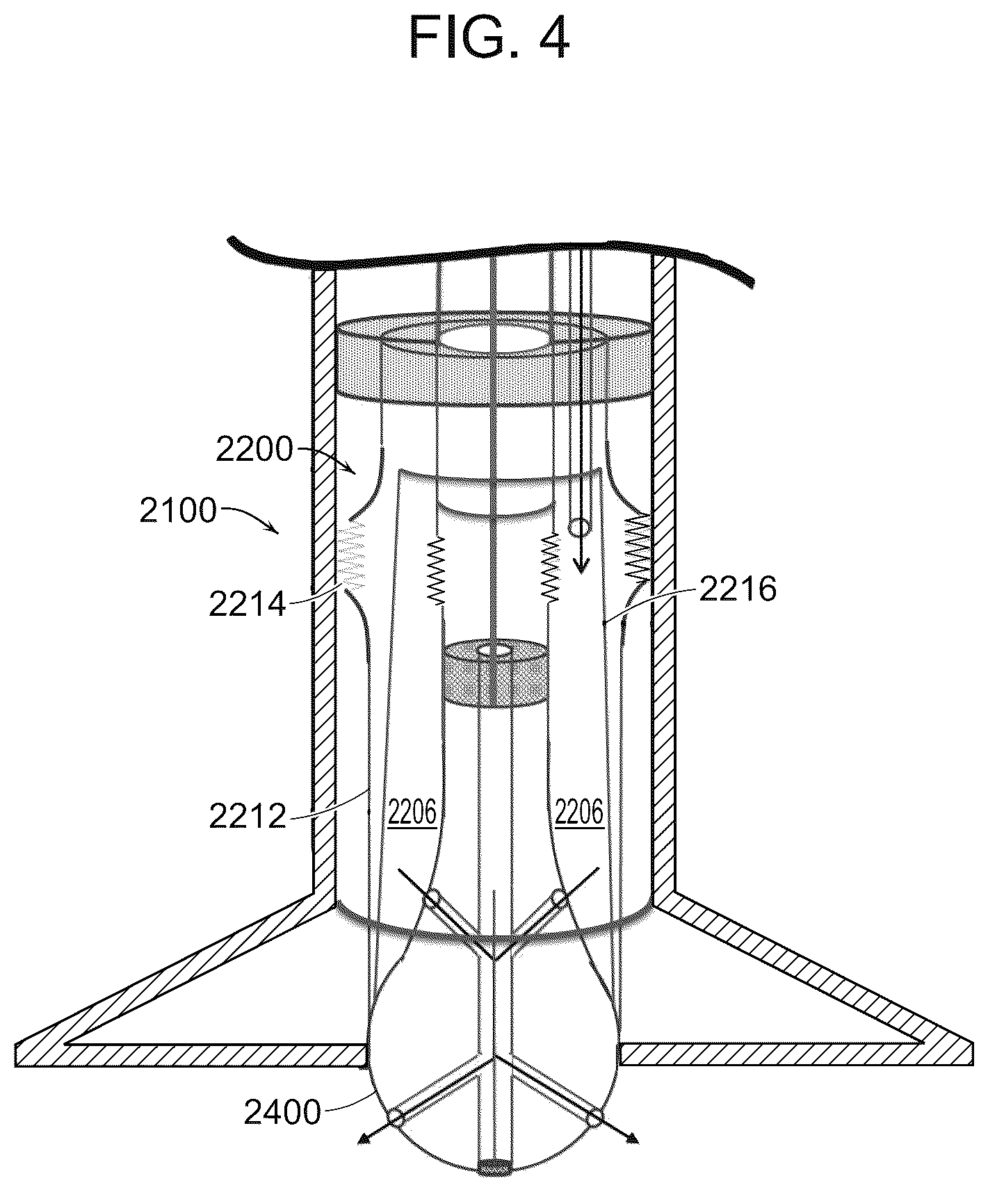 Patent US12599431 Figure 4 – Catheter and method for improved irrigation