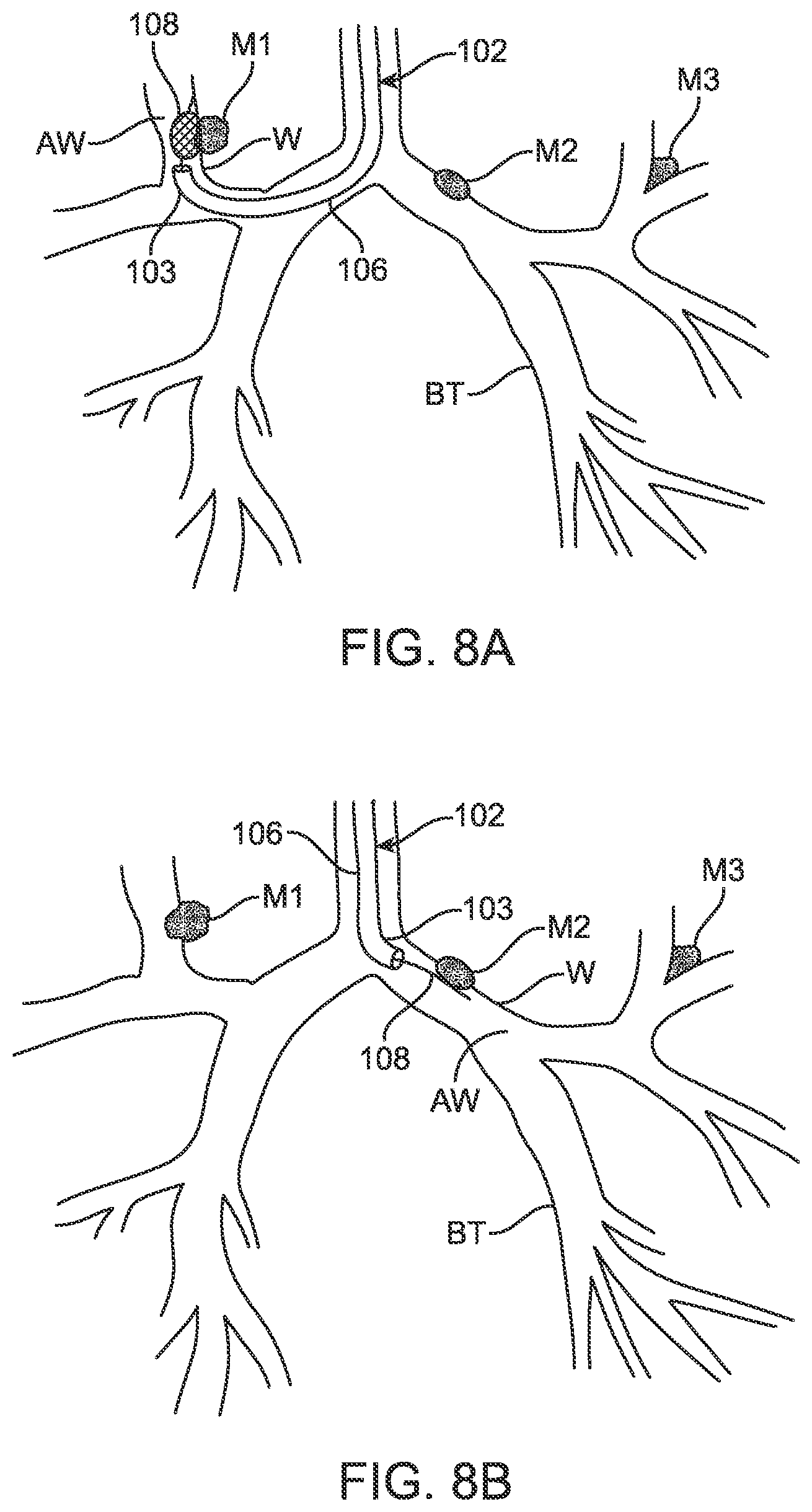 Patent US12599432 Figure 13 – Devices, systems and methods for the treatment of abnormal tissue