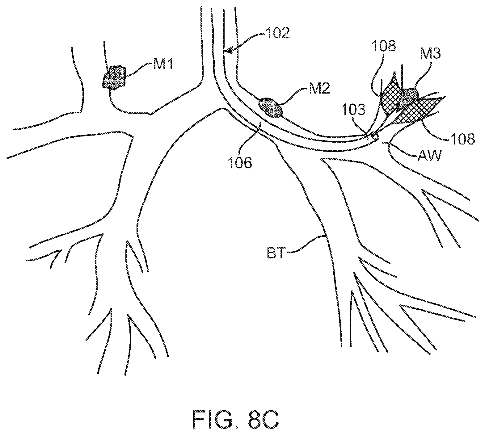 Patent US12599432 Figure 14 – Devices, systems and methods for the treatment of abnormal tissue