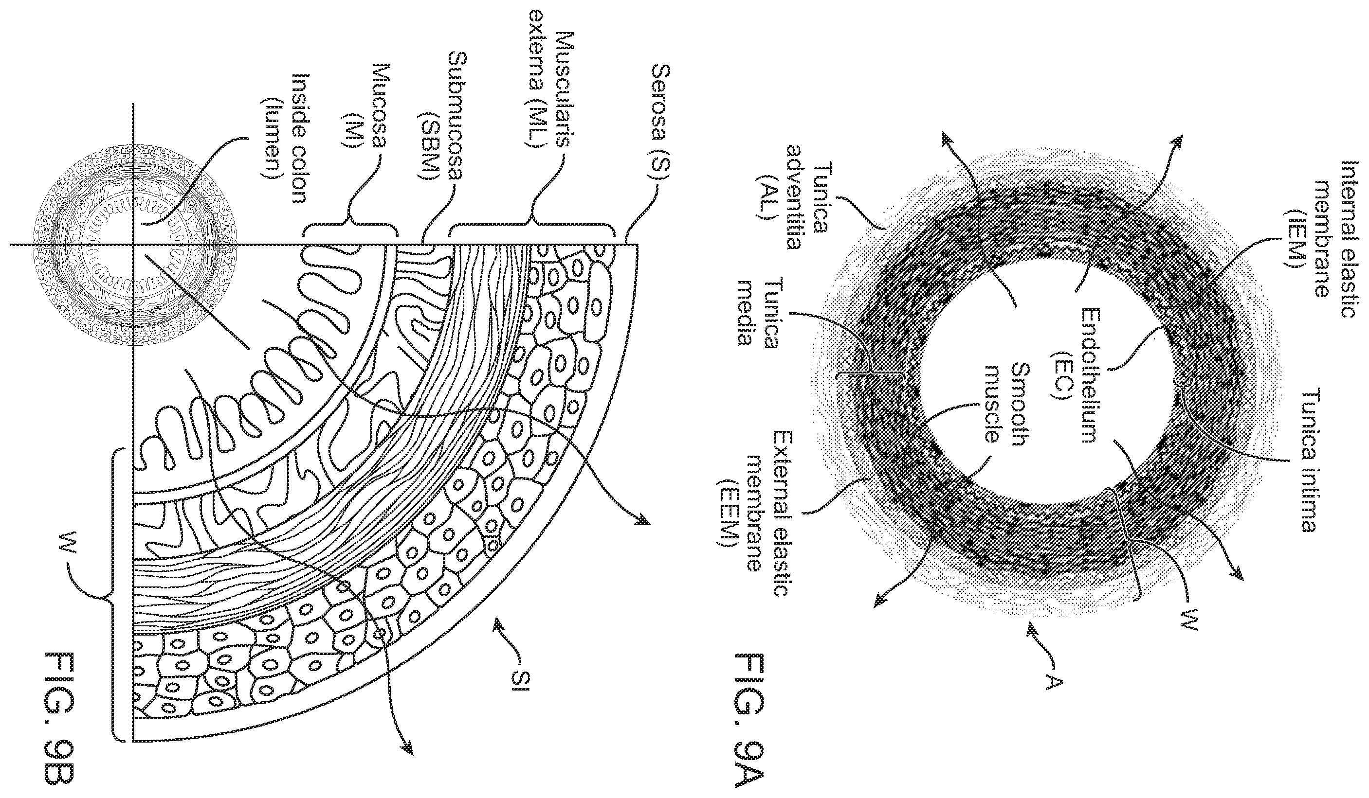 Patent US12599432 Figure 15 – Devices, systems and methods for the treatment of abnormal tissue
