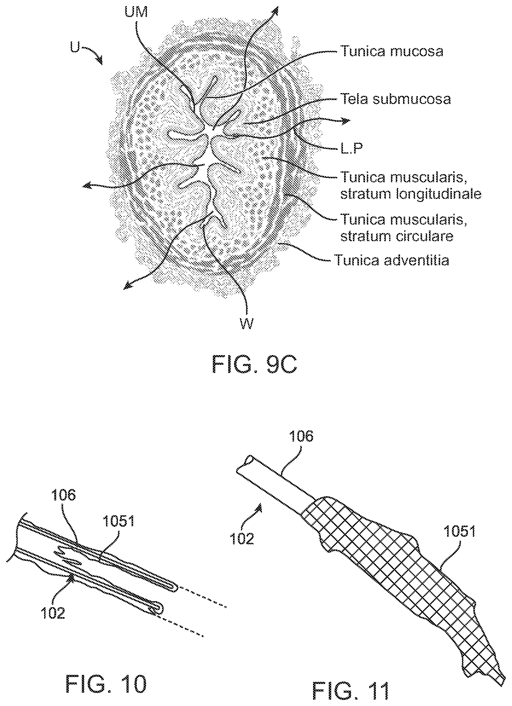 Patent US12599432 Figure 16 – Devices, systems and methods for the treatment of abnormal tissue