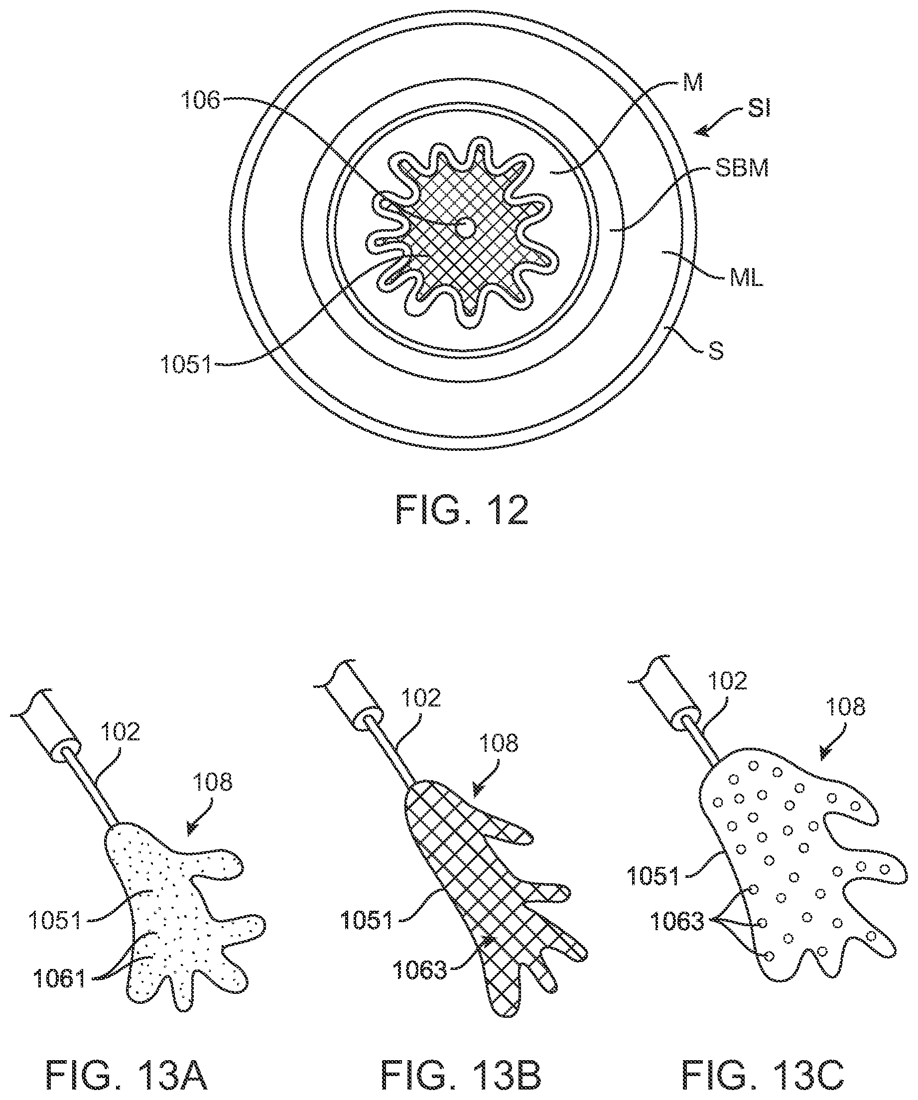 Patent US12599432 Figure 17 – Devices, systems and methods for the treatment of abnormal tissue
