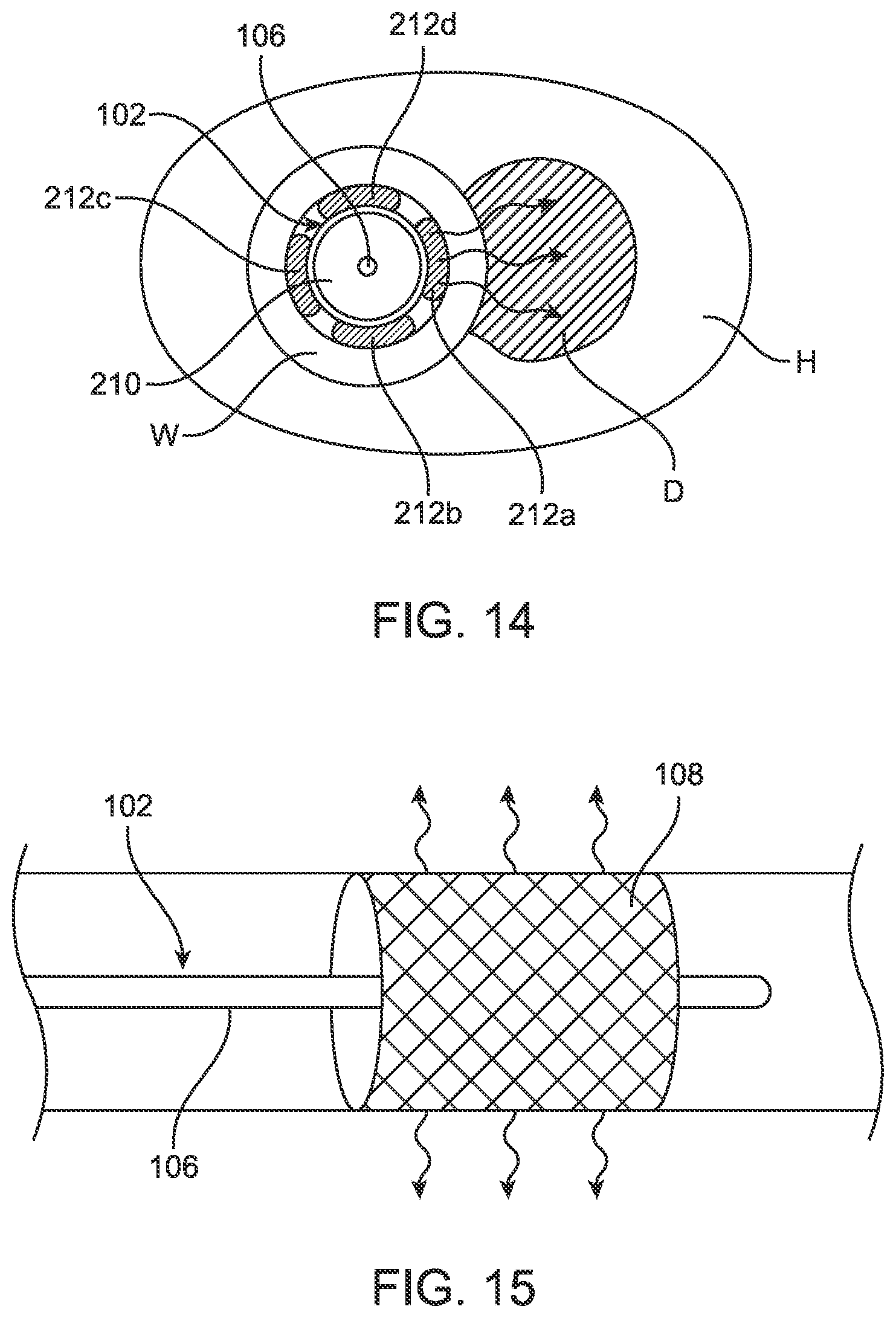 Patent US12599432 Figure 18 – Devices, systems and methods for the treatment of abnormal tissue