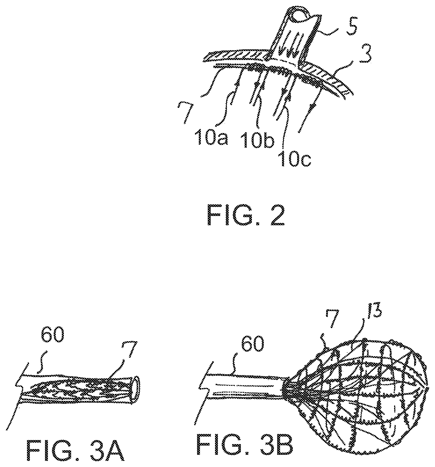 Patent US12599433 Figure 2 – Apparatus and method for intra-cardiac mapping and ablation