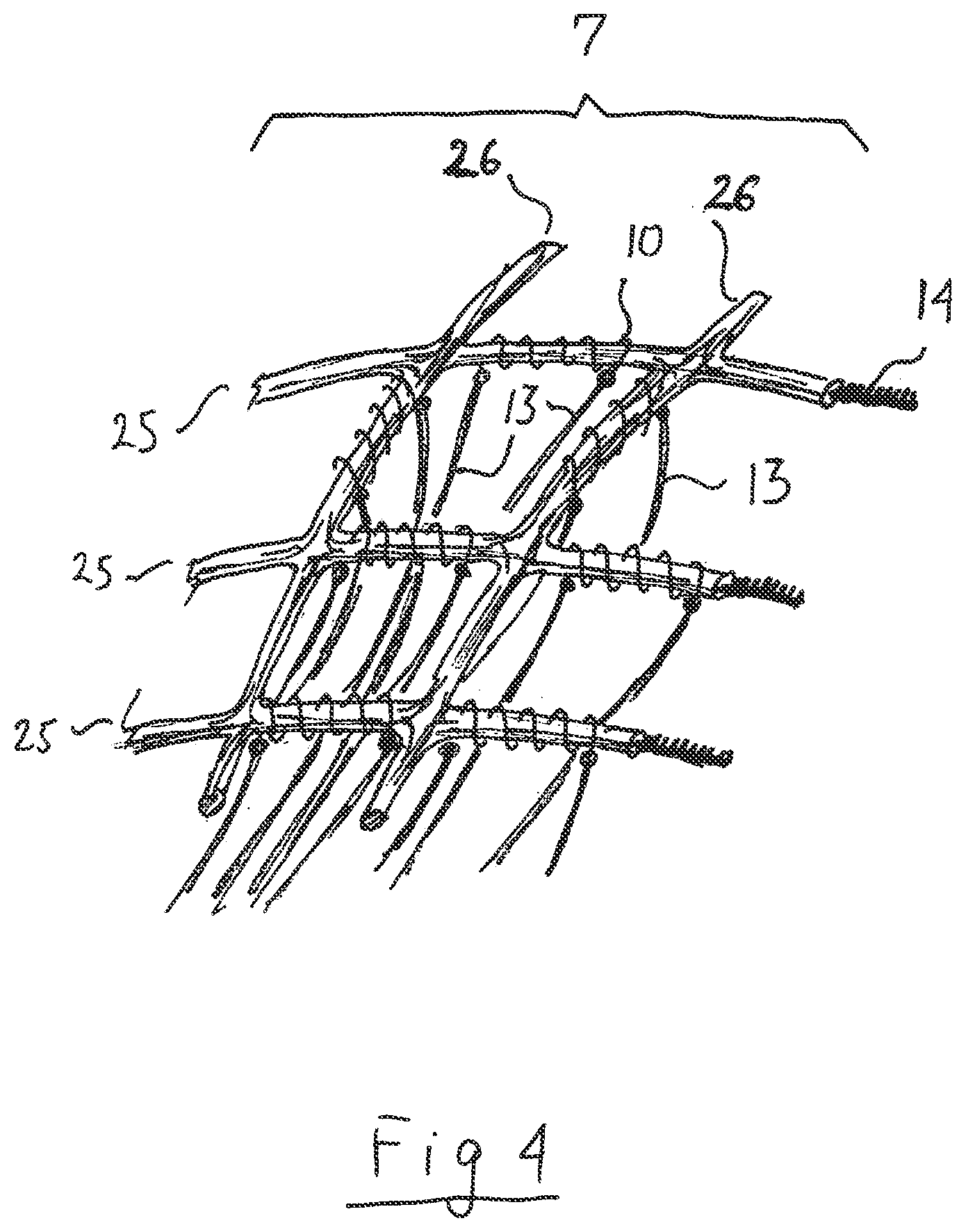 Patent US12599433 Figure 3 – Apparatus and method for intra-cardiac mapping and ablation