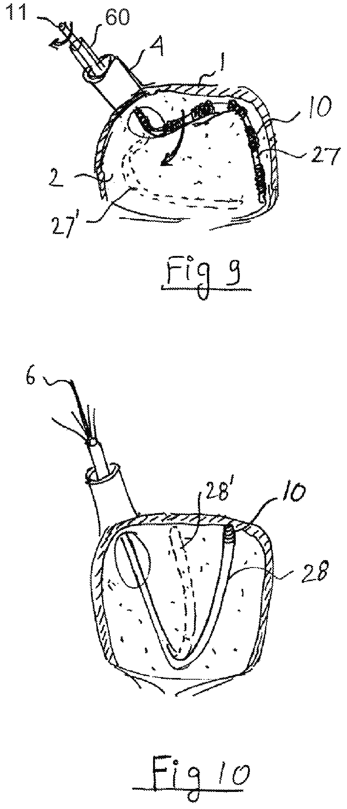 Patent US12599433 Figure 7 – Apparatus and method for intra-cardiac mapping and ablation