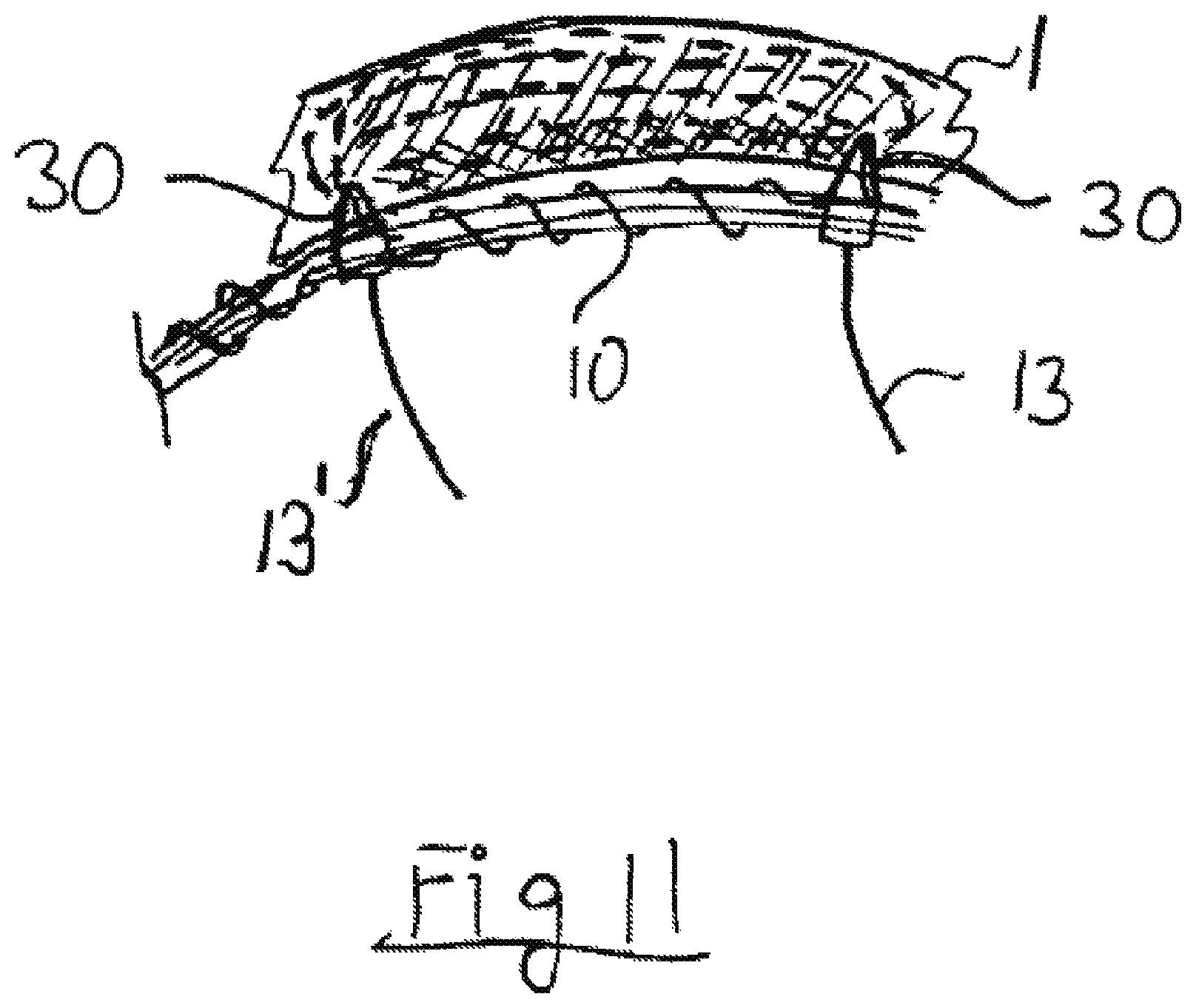 Patent US12599433 Figure 8 – Apparatus and method for intra-cardiac mapping and ablation