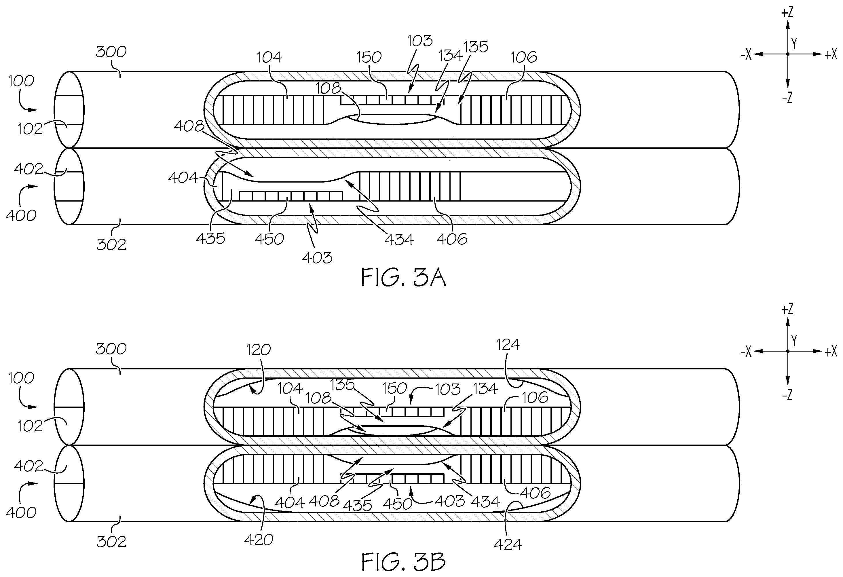Patent US12599434 Figure 4 – Catheter systems with biasing rails and methods for forming fistulas