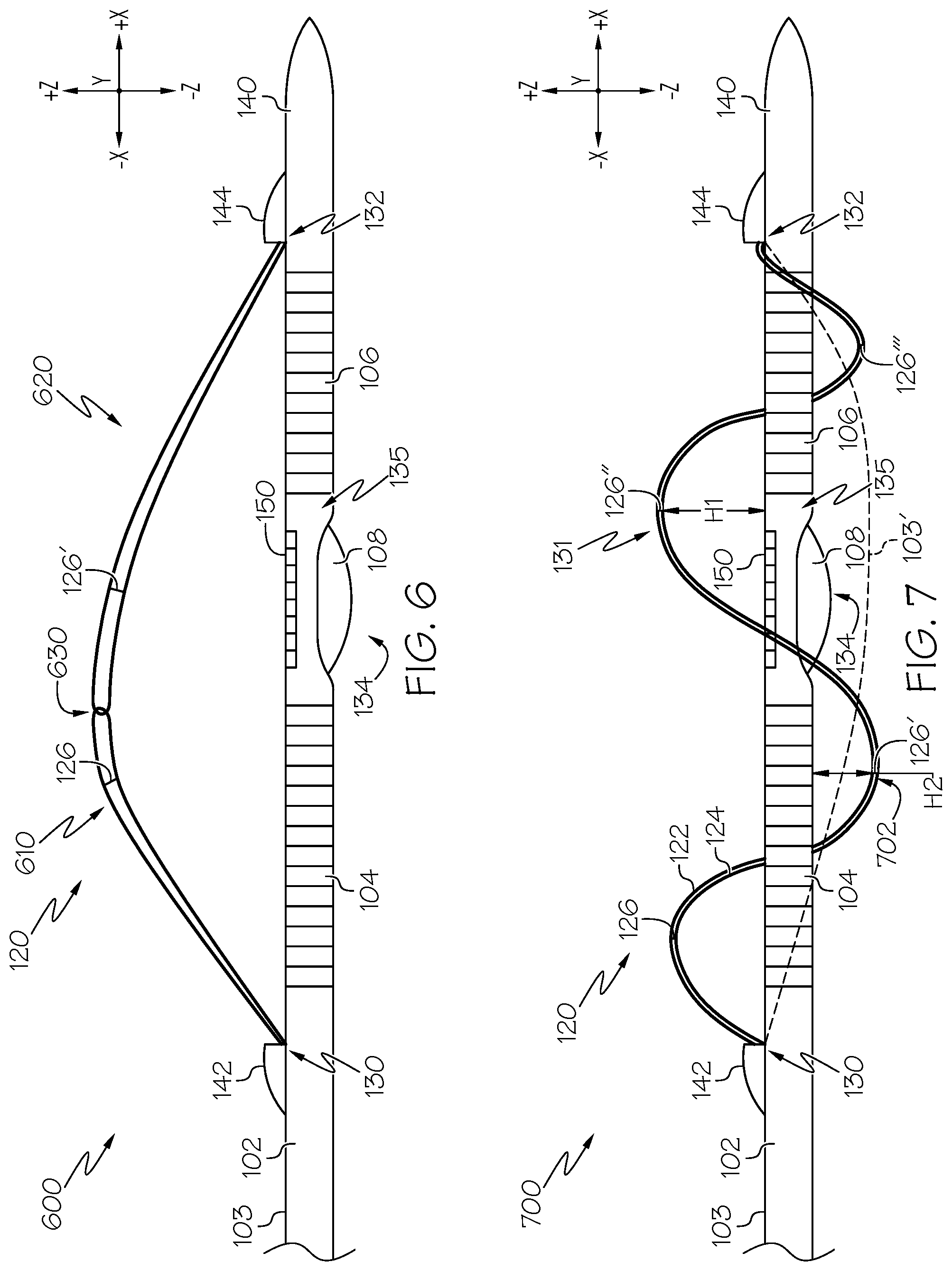 Patent US12599434 Figure 6 – Catheter systems with biasing rails and methods for forming fistulas