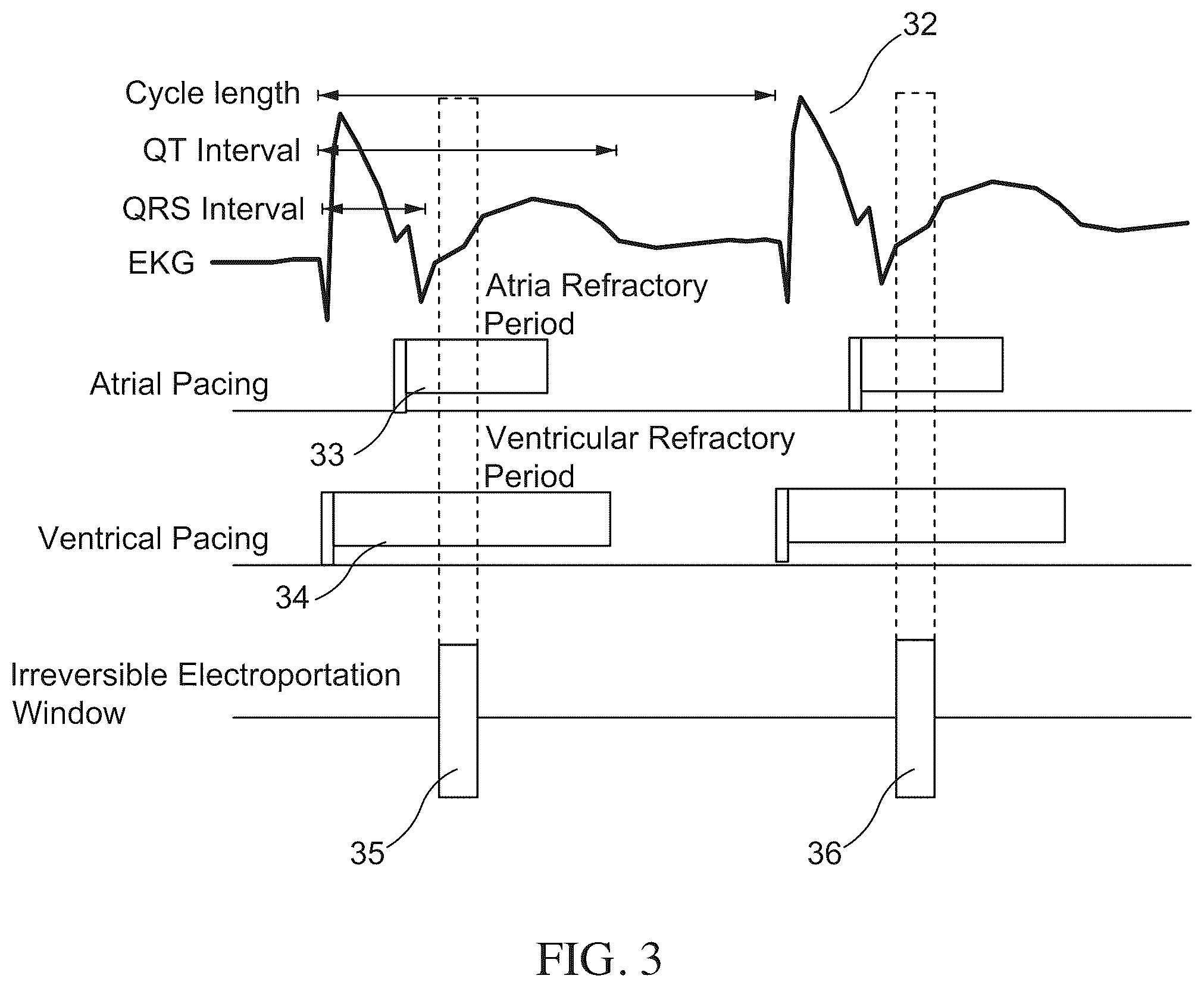 Patent US12599435 Figure 3 – Methods and apparatus for selective tissue ablation