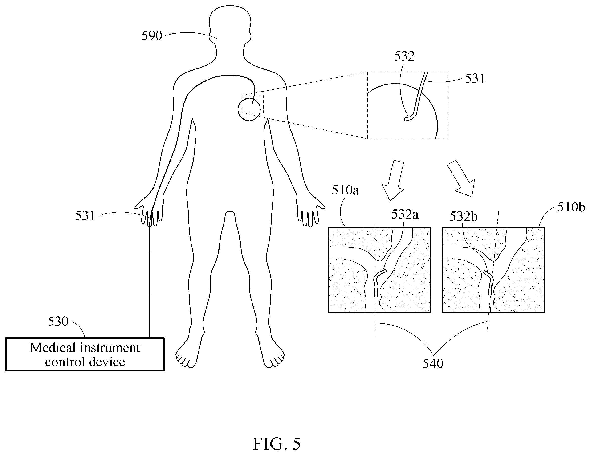 Patent US12599436 Figure 5 – Method and apparatus for training operation determination model for medical instrument control device