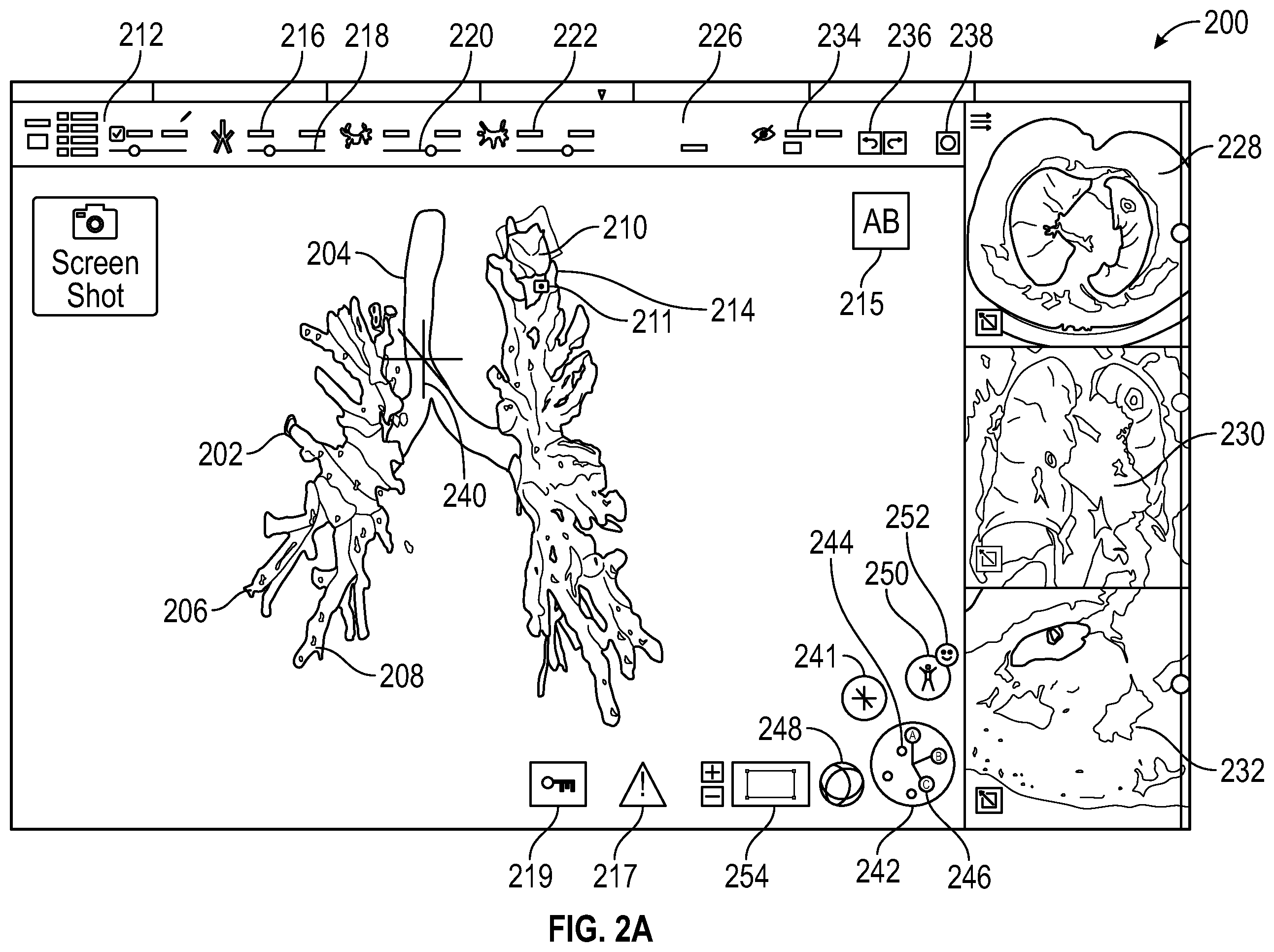 Patent US12599437 Figure 2 – Pre-procedure planning, intra-procedure guidance for biopsy, and ablation of tumors with and without cone-beam computed tomography or fluoroscopic imaging