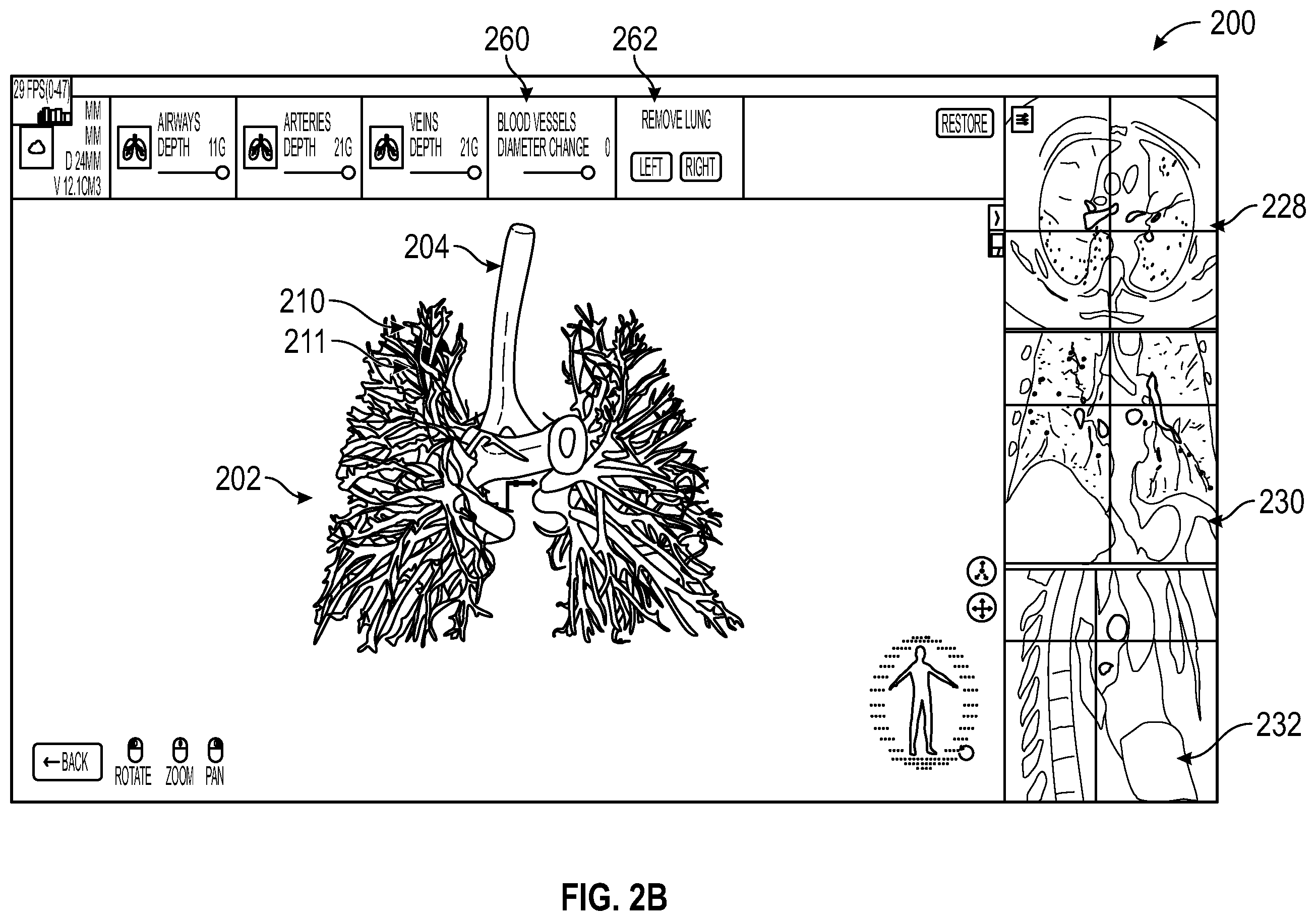 Patent US12599437 Figure 3 – Pre-procedure planning, intra-procedure guidance for biopsy, and ablation of tumors with and without cone-beam computed tomography or fluoroscopic imaging
