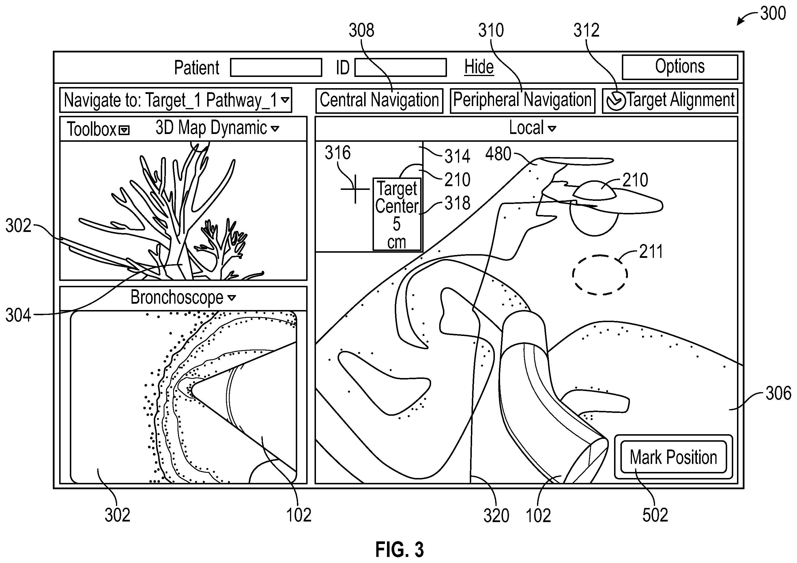 Patent US12599437 Figure 4 – Pre-procedure planning, intra-procedure guidance for biopsy, and ablation of tumors with and without cone-beam computed tomography or fluoroscopic imaging