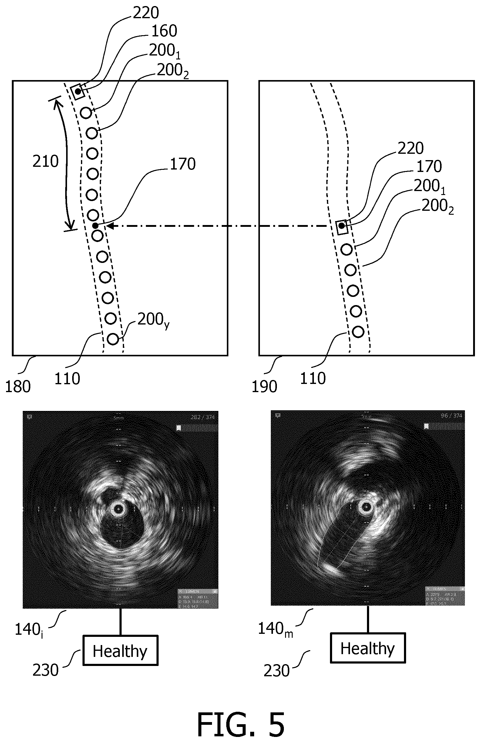 Patent US12599438 Figure 3 – Determining end point locations for a stent