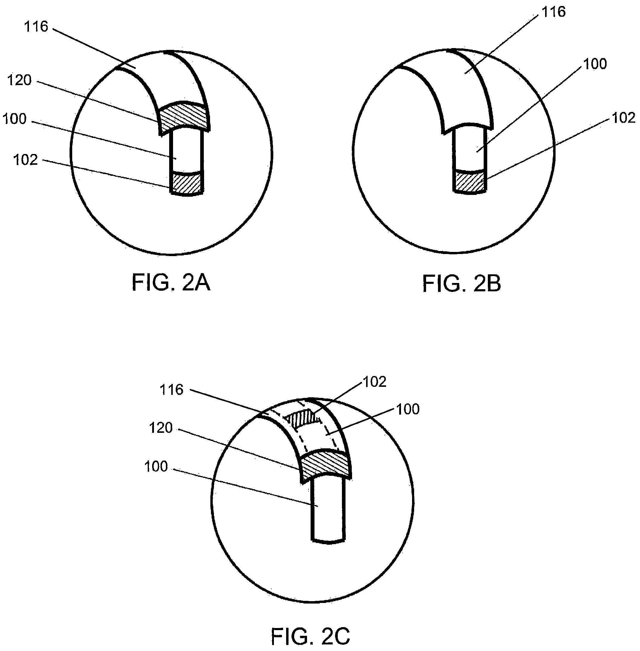 Patent US12599439 Figure 3 – System and method to access lung tissue