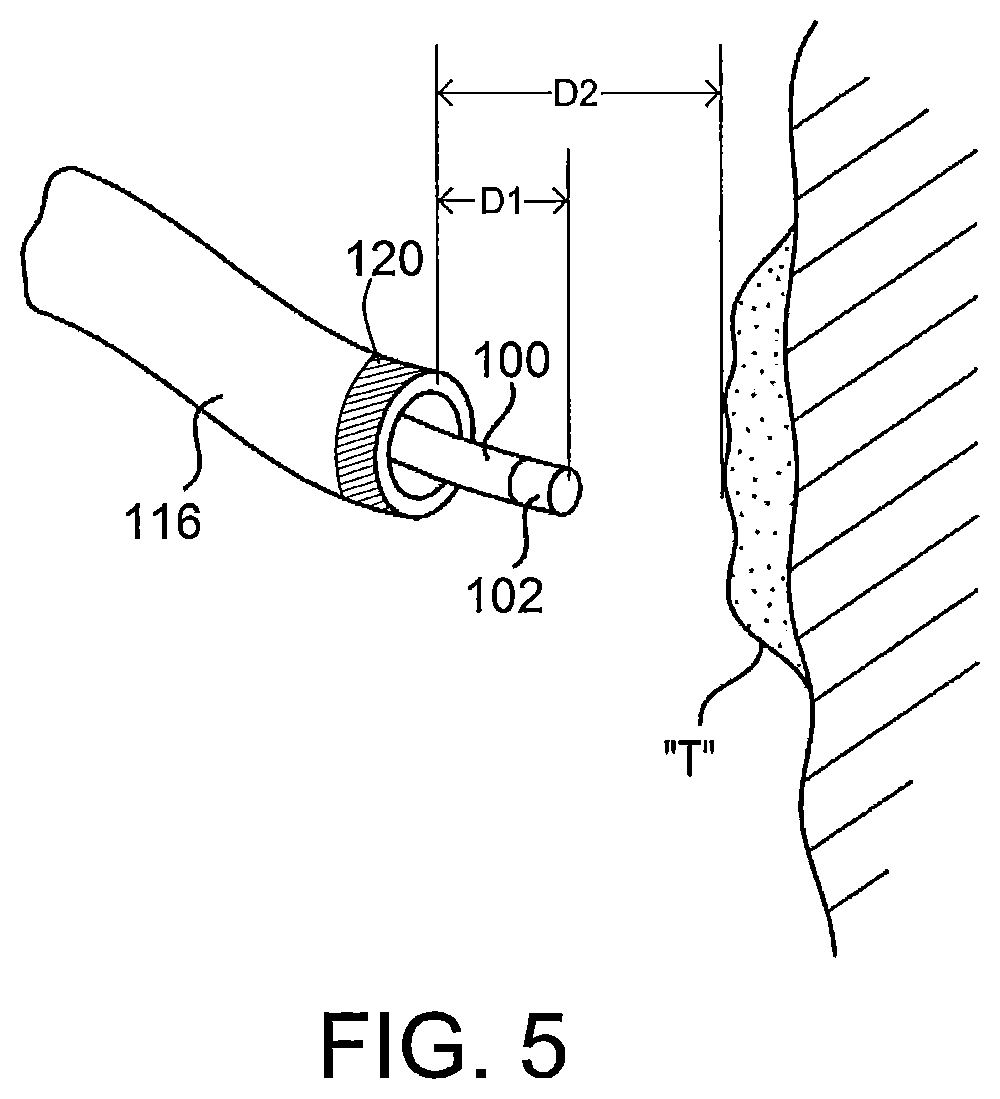 Patent US12599439 Figure 6 – System and method to access lung tissue