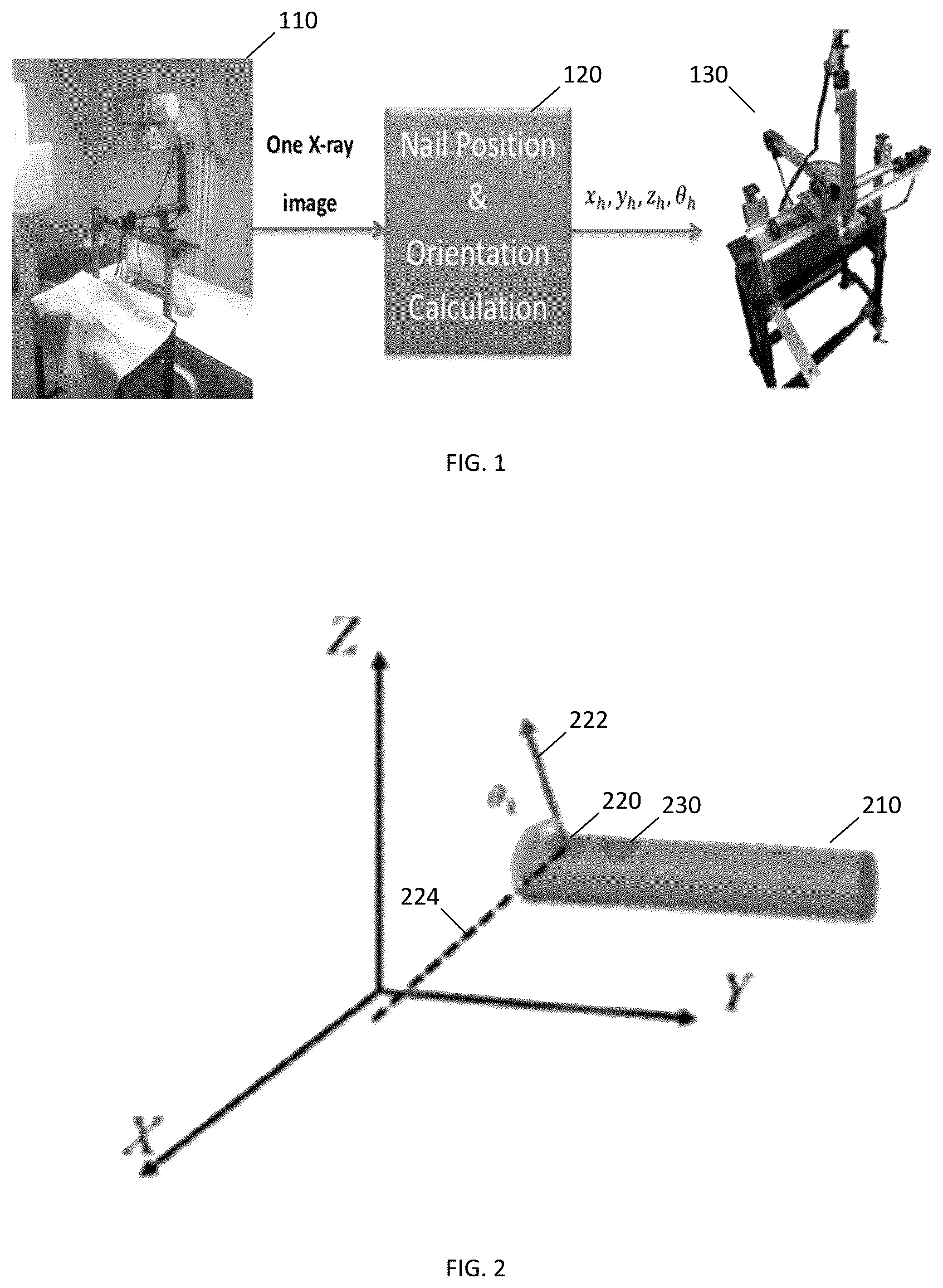 Patent US12599442 Figure 1 – Assistive surgical robot for distal hole localization in intramedullary nail