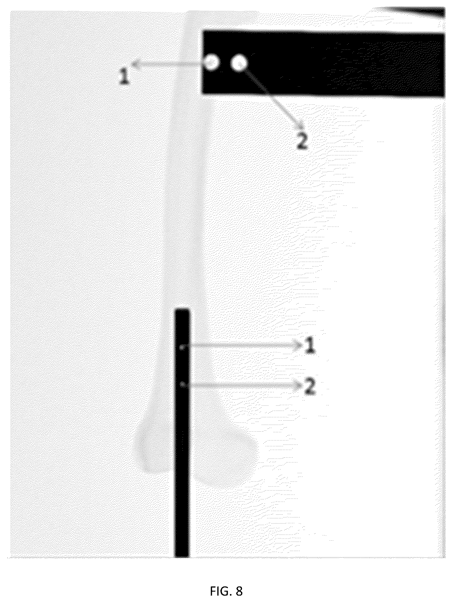 Patent US12599442 Figure 5 – Assistive surgical robot for distal hole localization in intramedullary nail