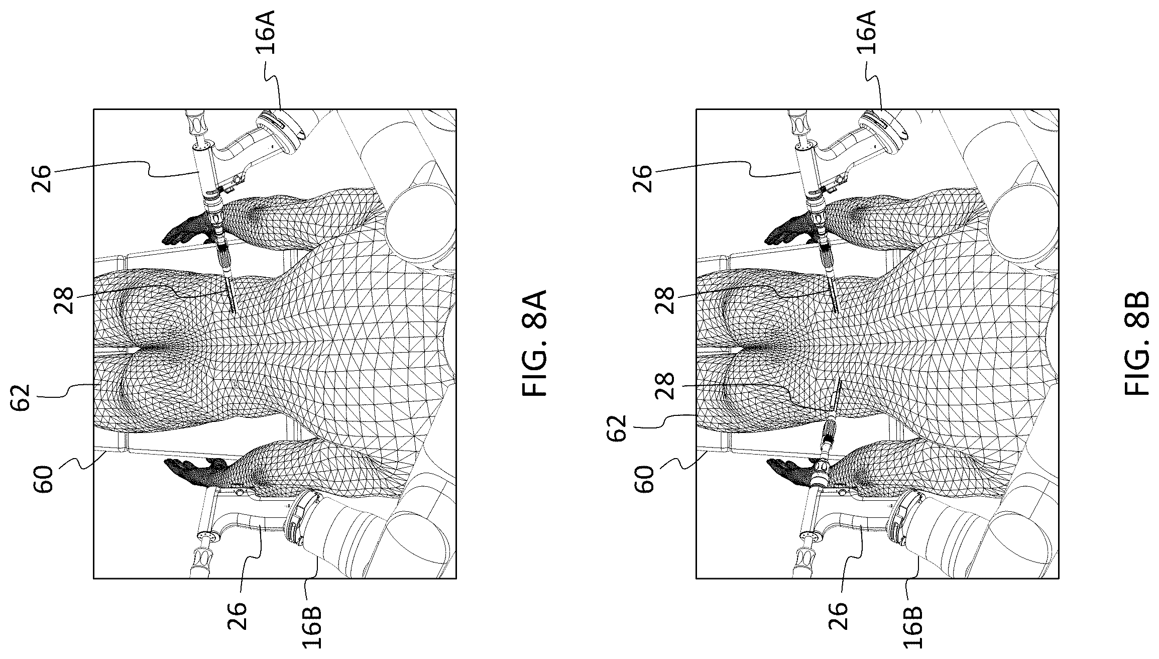 Patent US12599447 Figure 8 – Surgical robotic system