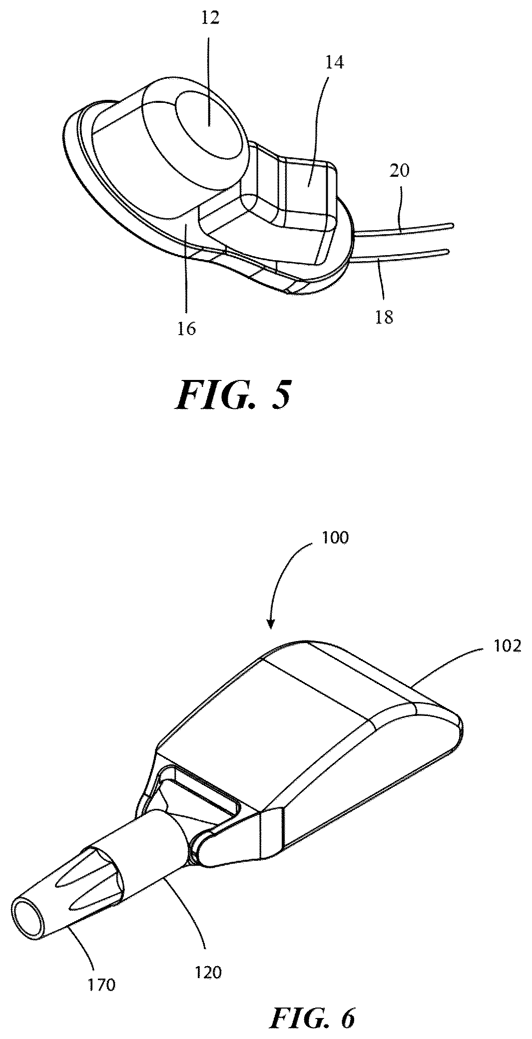 Patent US12599453 Figure 3 – Oral expansion device