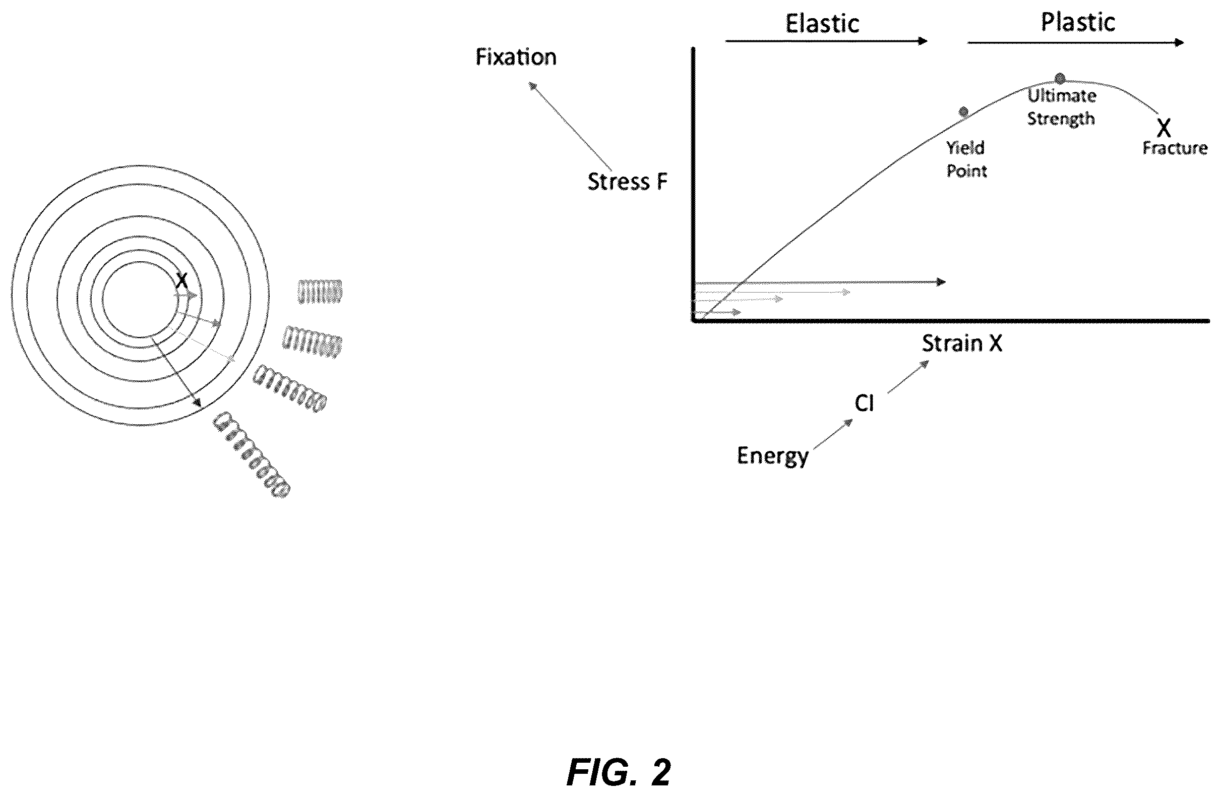 Patent US12599455 Figure 2 – Electronic signature for bone preparation