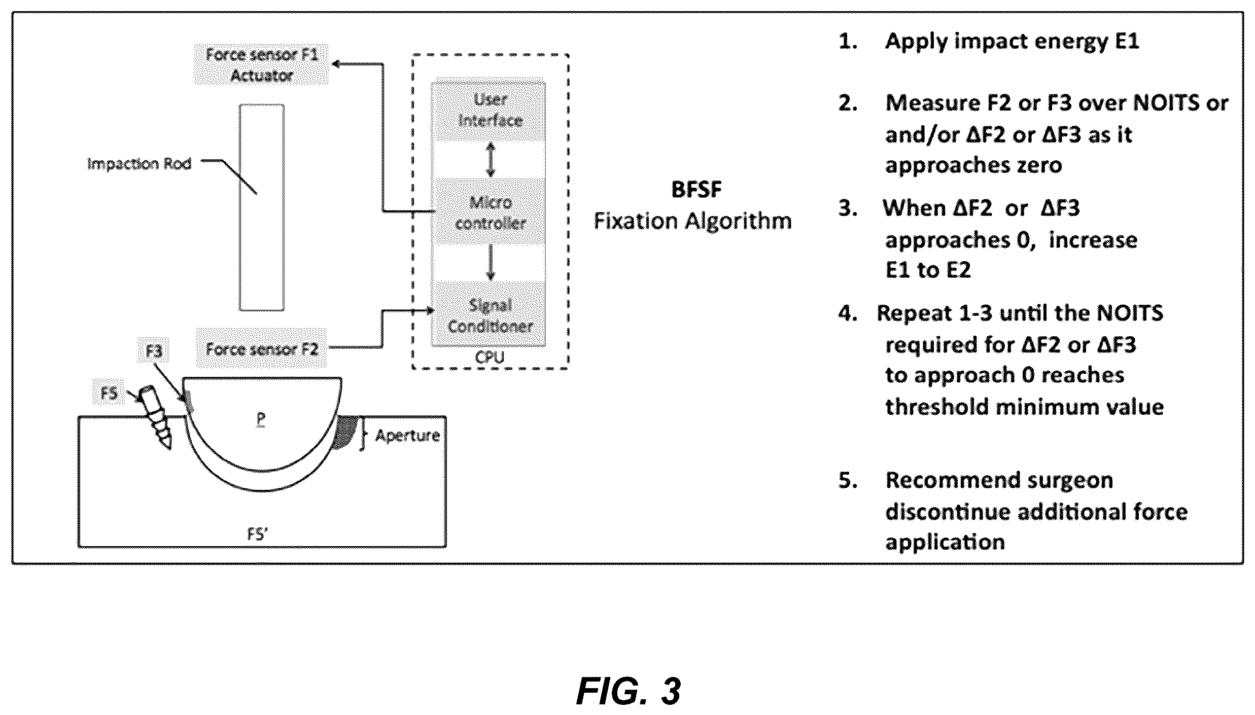 Patent US12599455 Figure 3 – Electronic signature for bone preparation