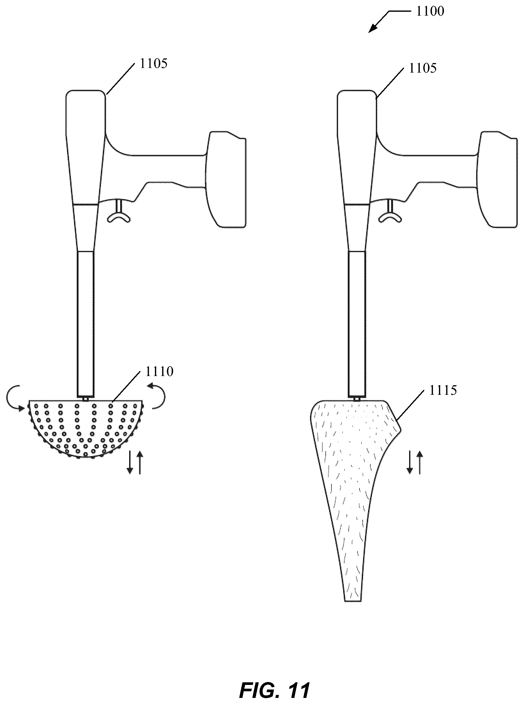 Patent US12599455 Figure 11 – Electronic signature for bone preparation