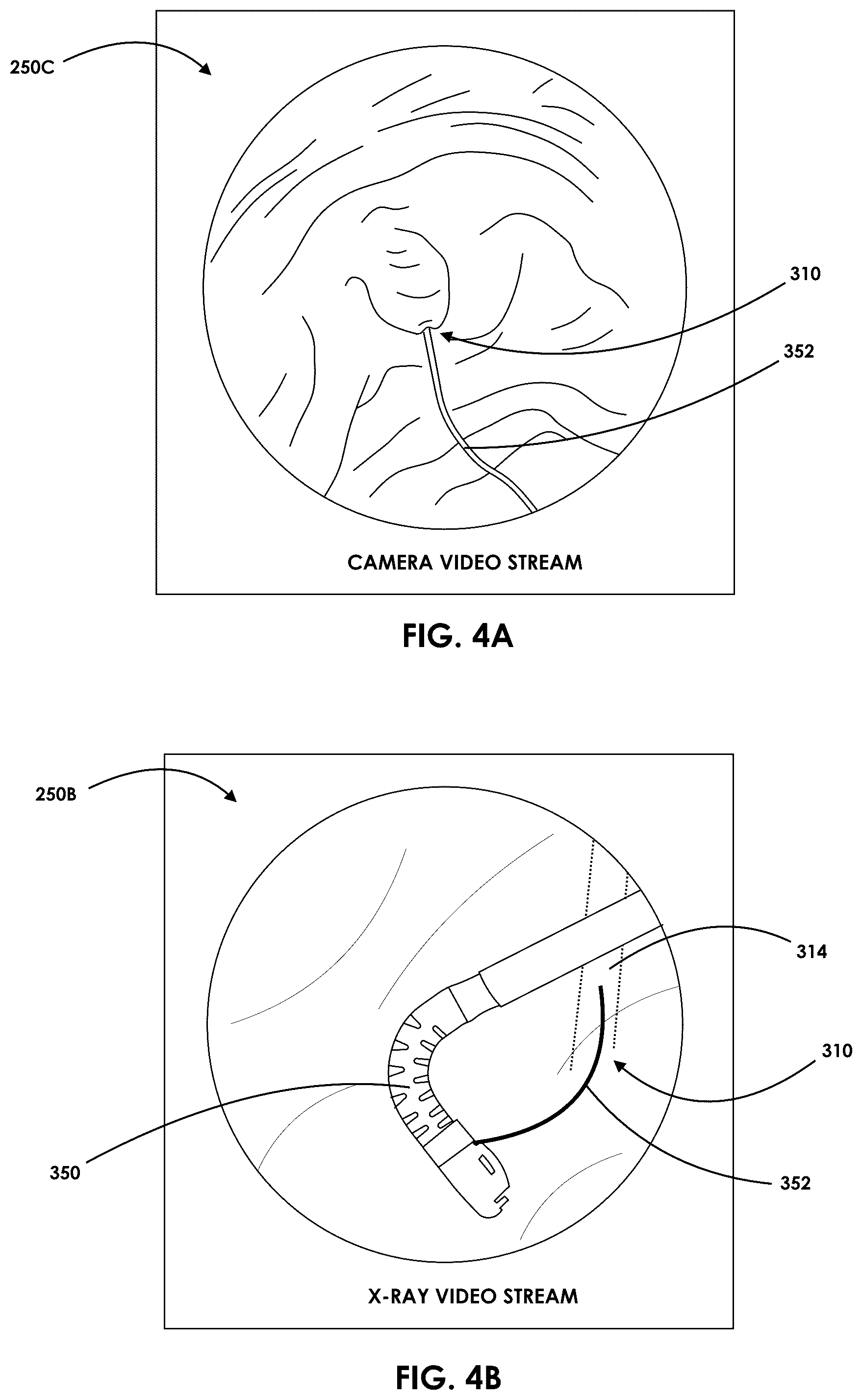 Patent US12599457 Figure 4 – Mixed reality endoscopic retrograde cholangiopancreatopgraphy (ERCP) procedure